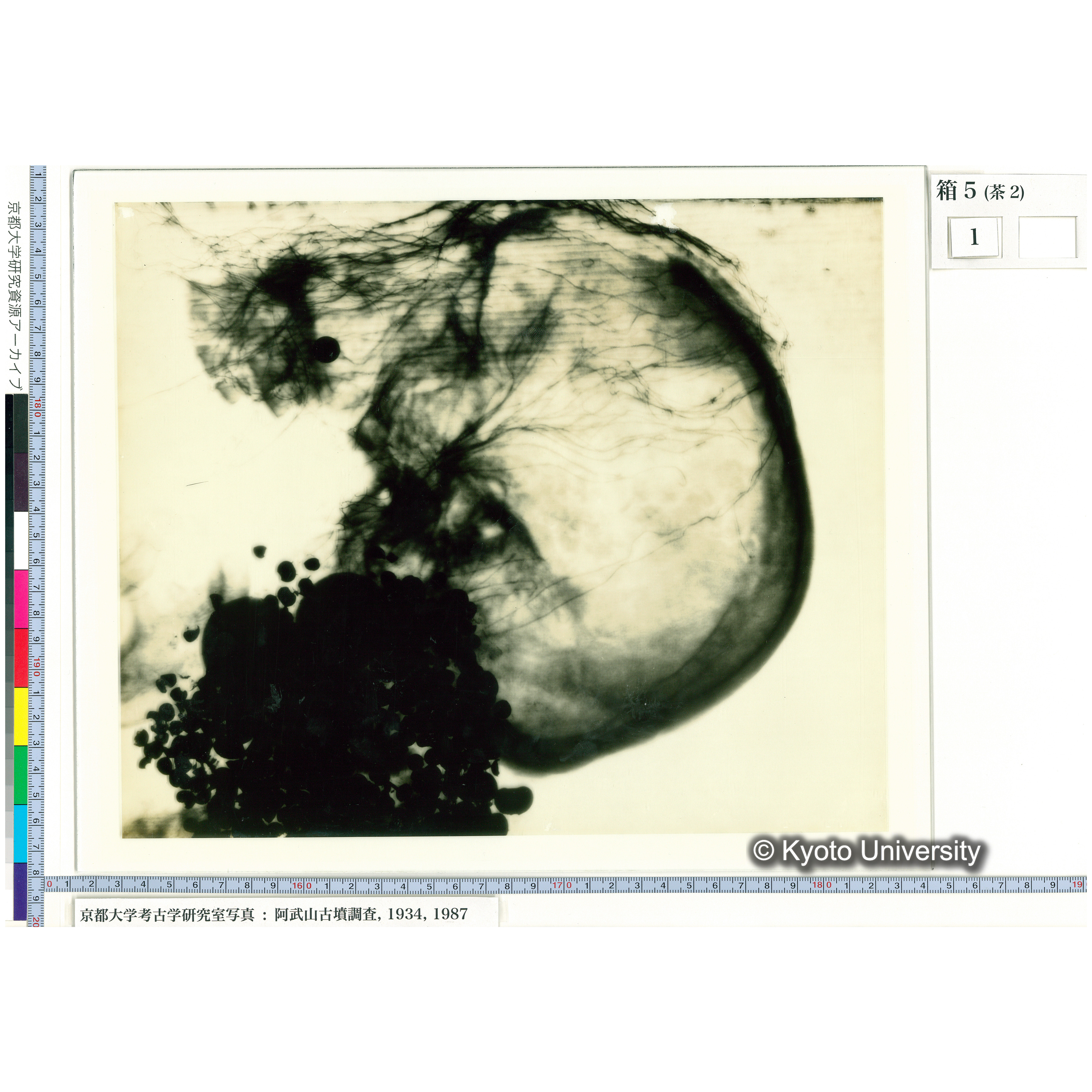 [乾板] 頭部レントゲン１ (1)