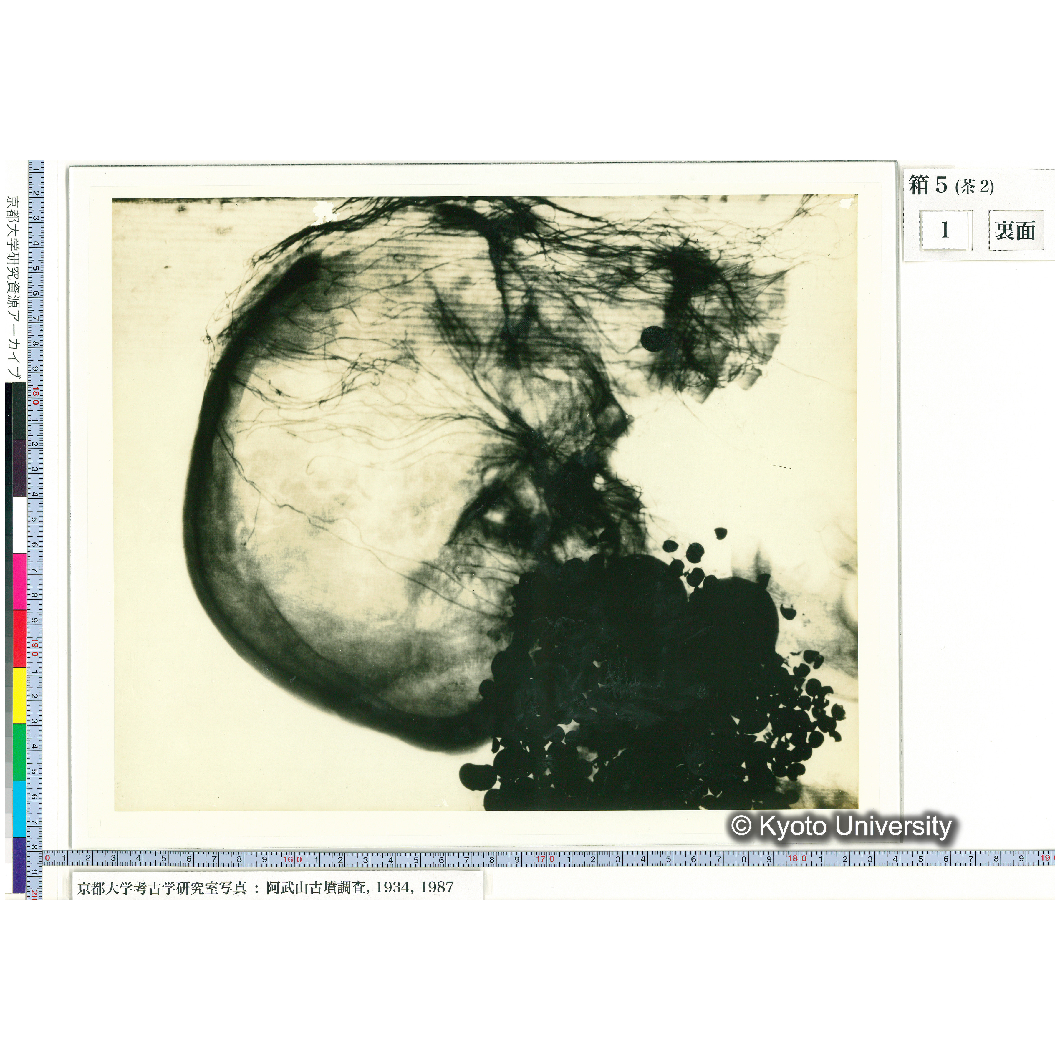 [乾板] 頭部レントゲン１ (2)