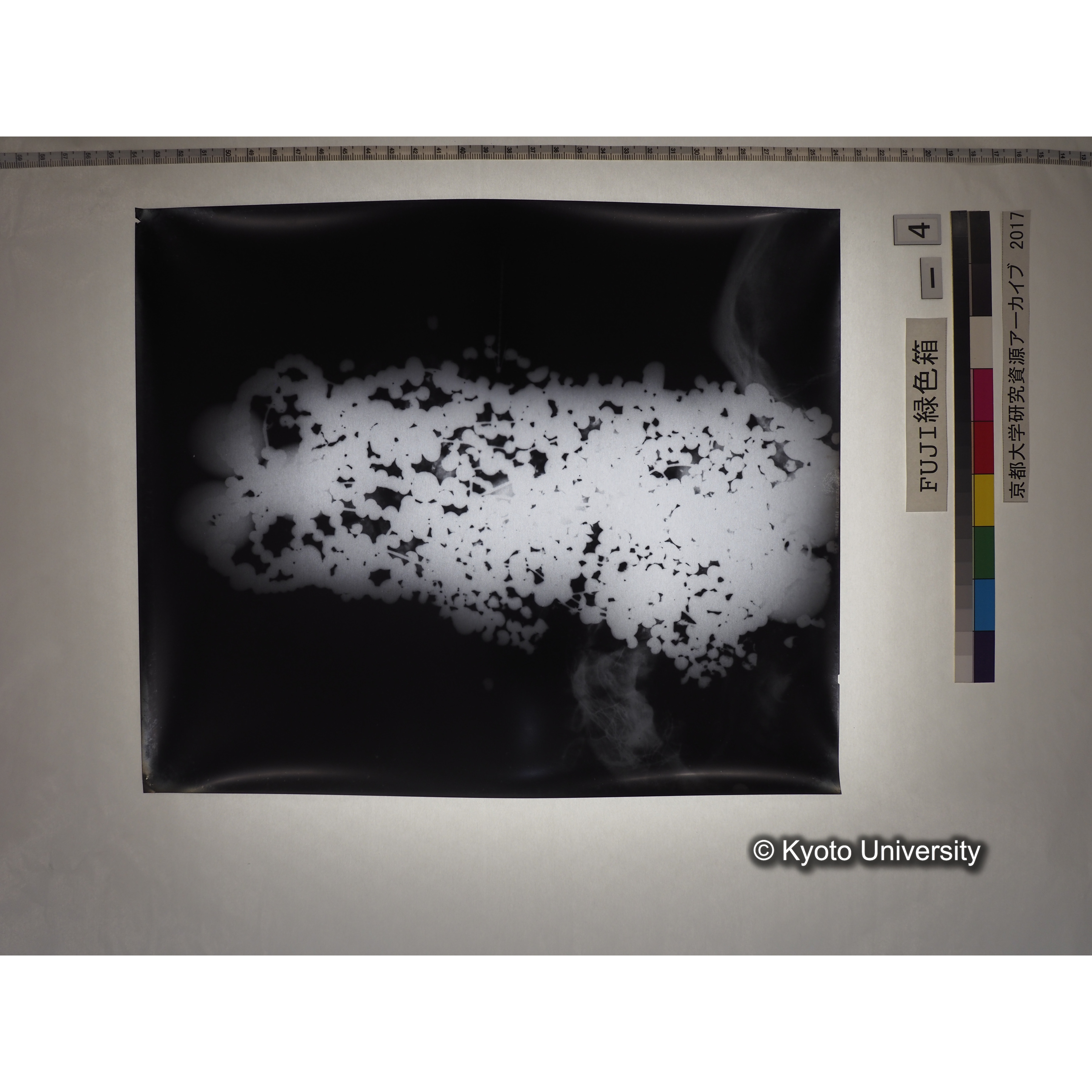 [フィルム] 玉枕レントゲン２ (1)