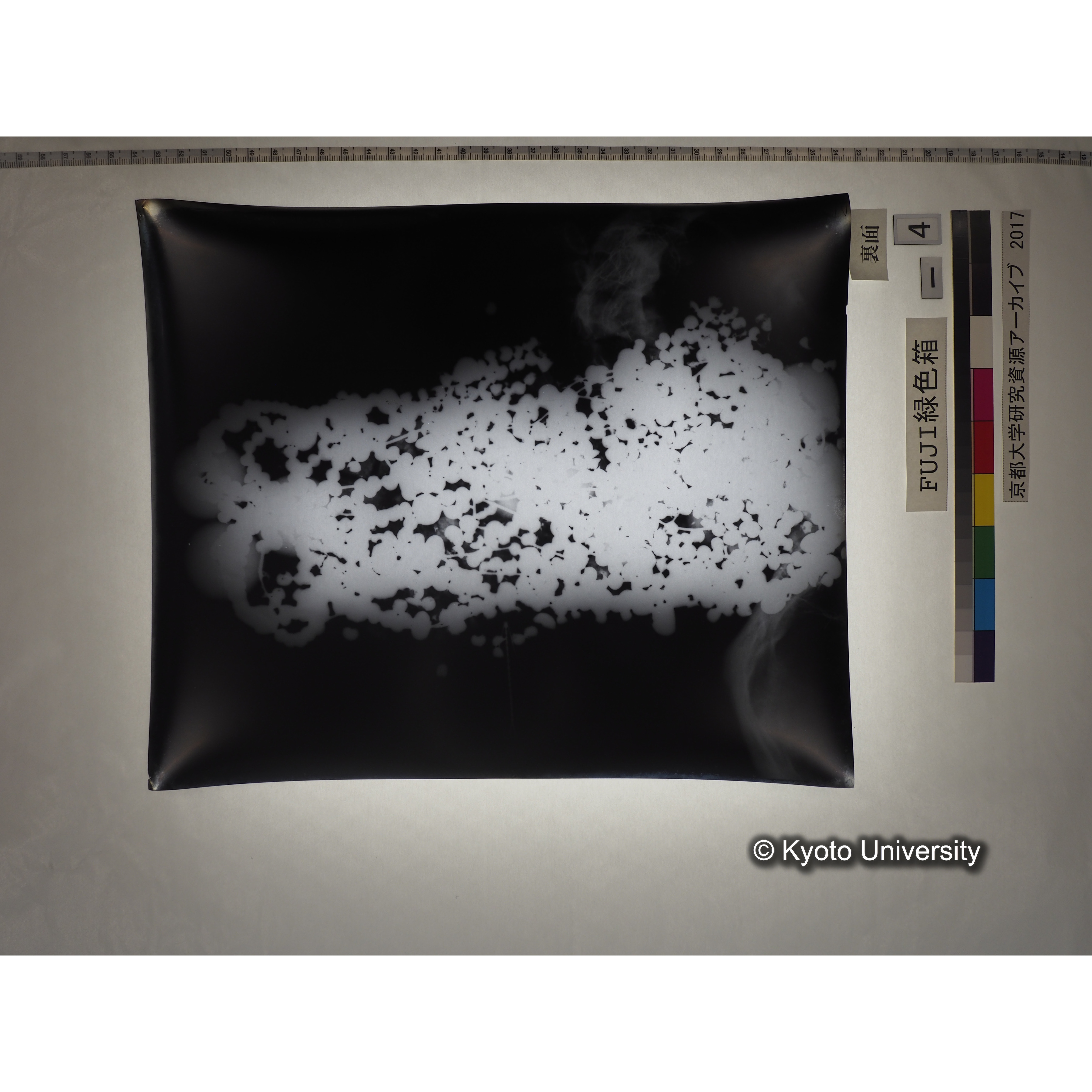 [フィルム] 玉枕レントゲン２ (2)