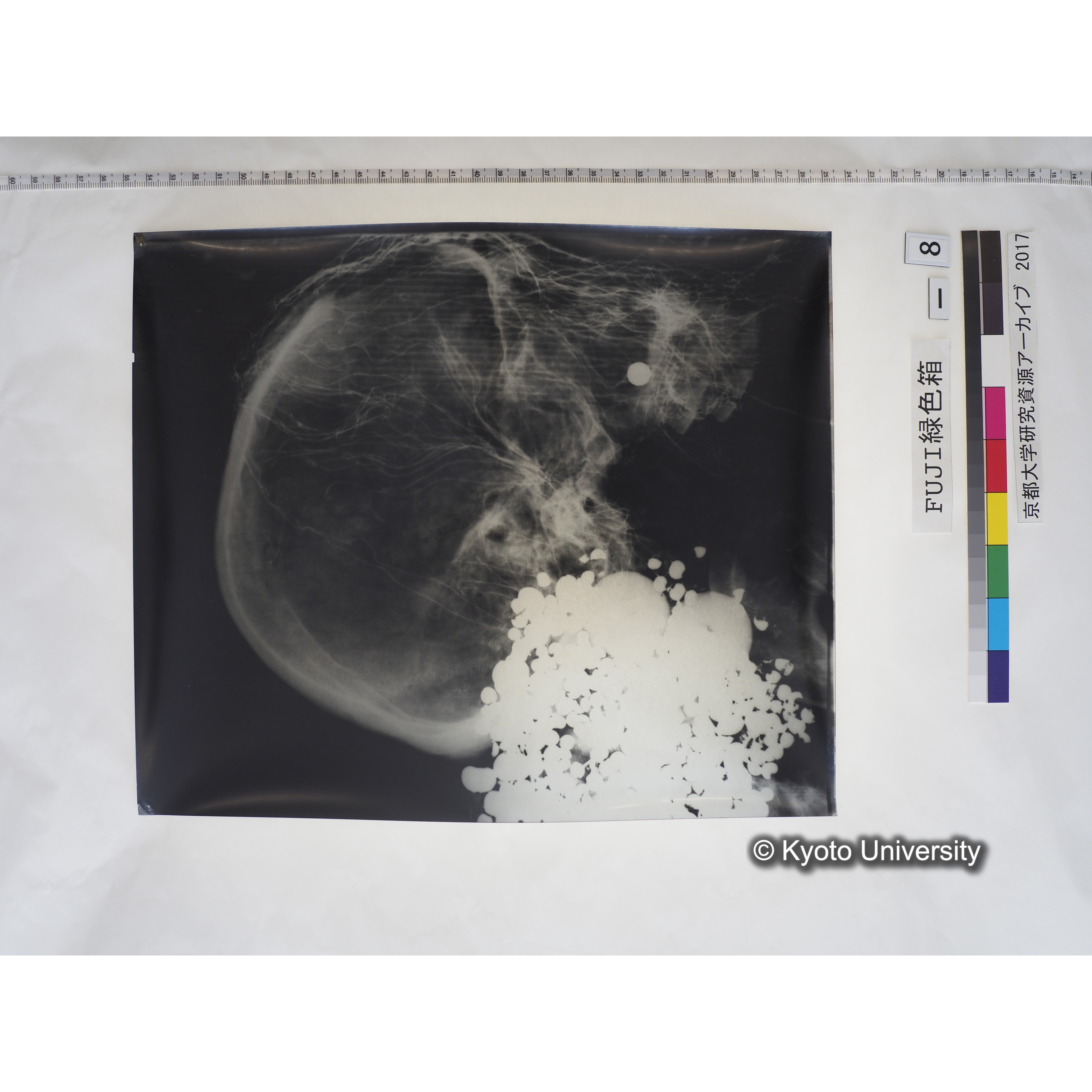 [フィルム] 頭部レントゲン１ (1)