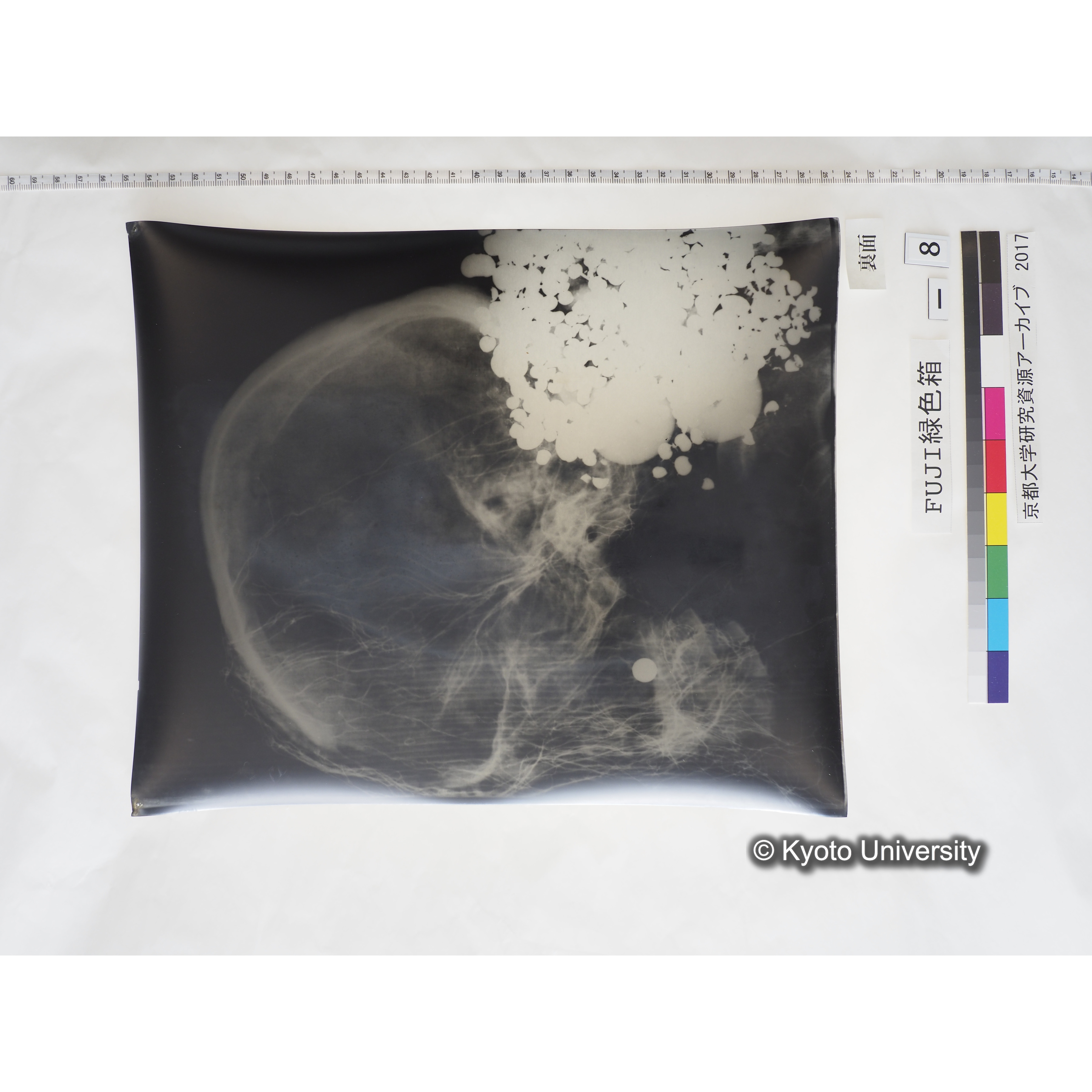 [フィルム] 頭部レントゲン１ (2)