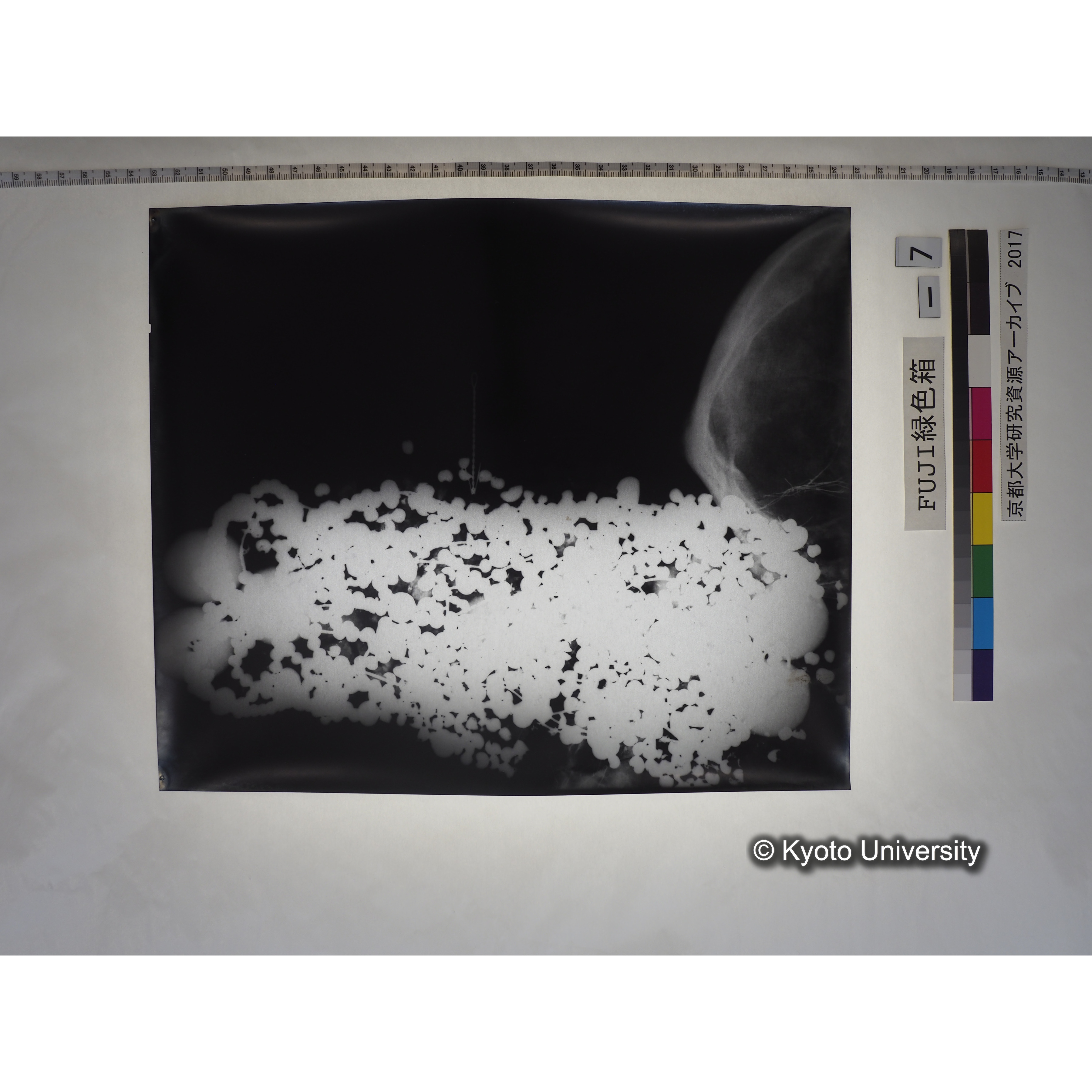 [フィルム] 玉枕レントゲン５ (1)