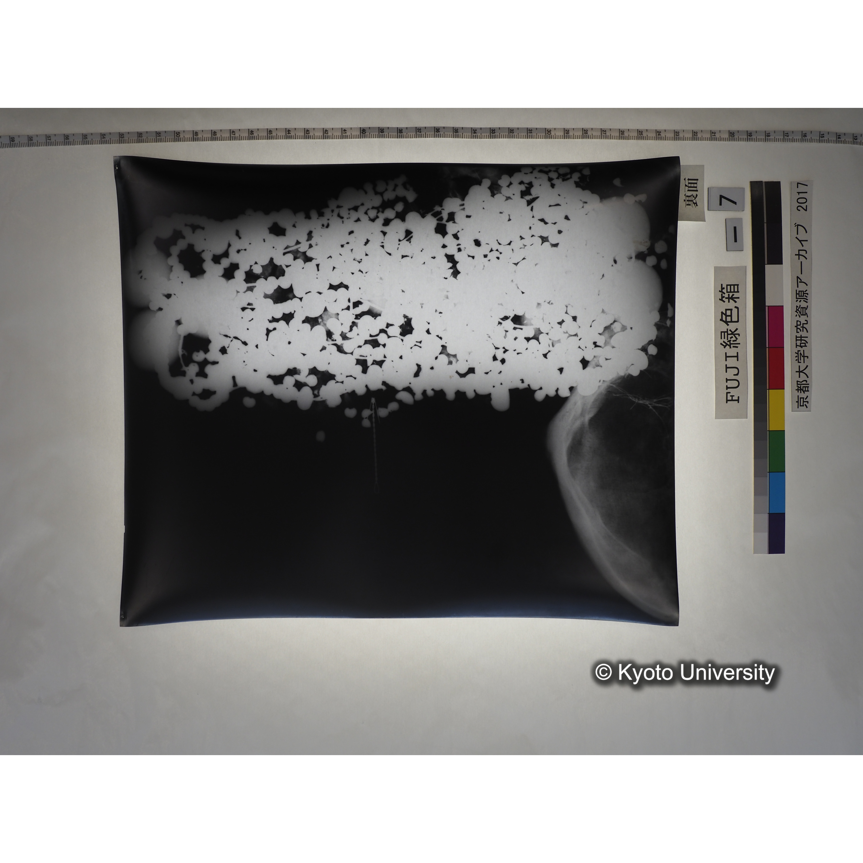 [フィルム] 玉枕レントゲン５ (2)