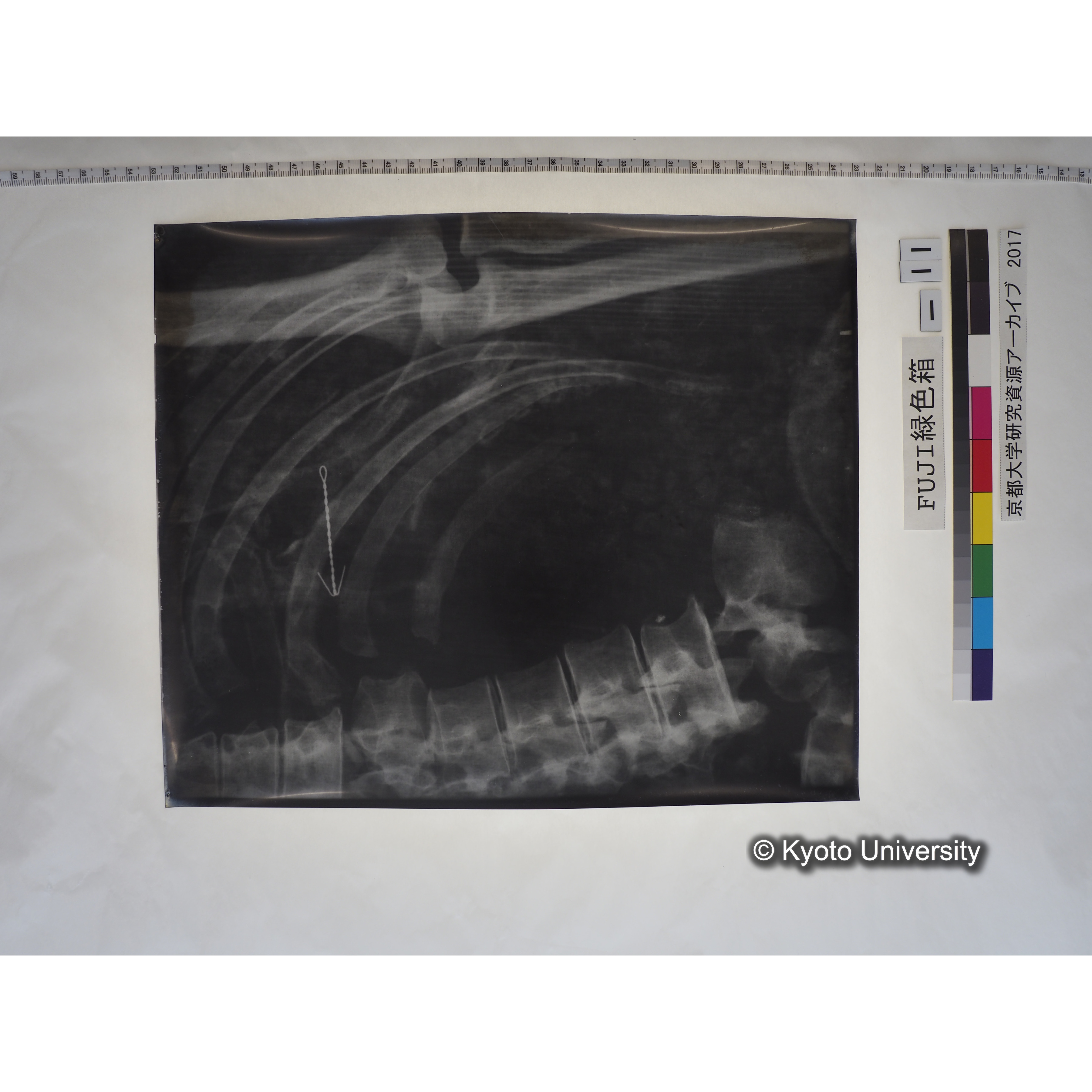 [フィルム] 胸部レントゲン (1)