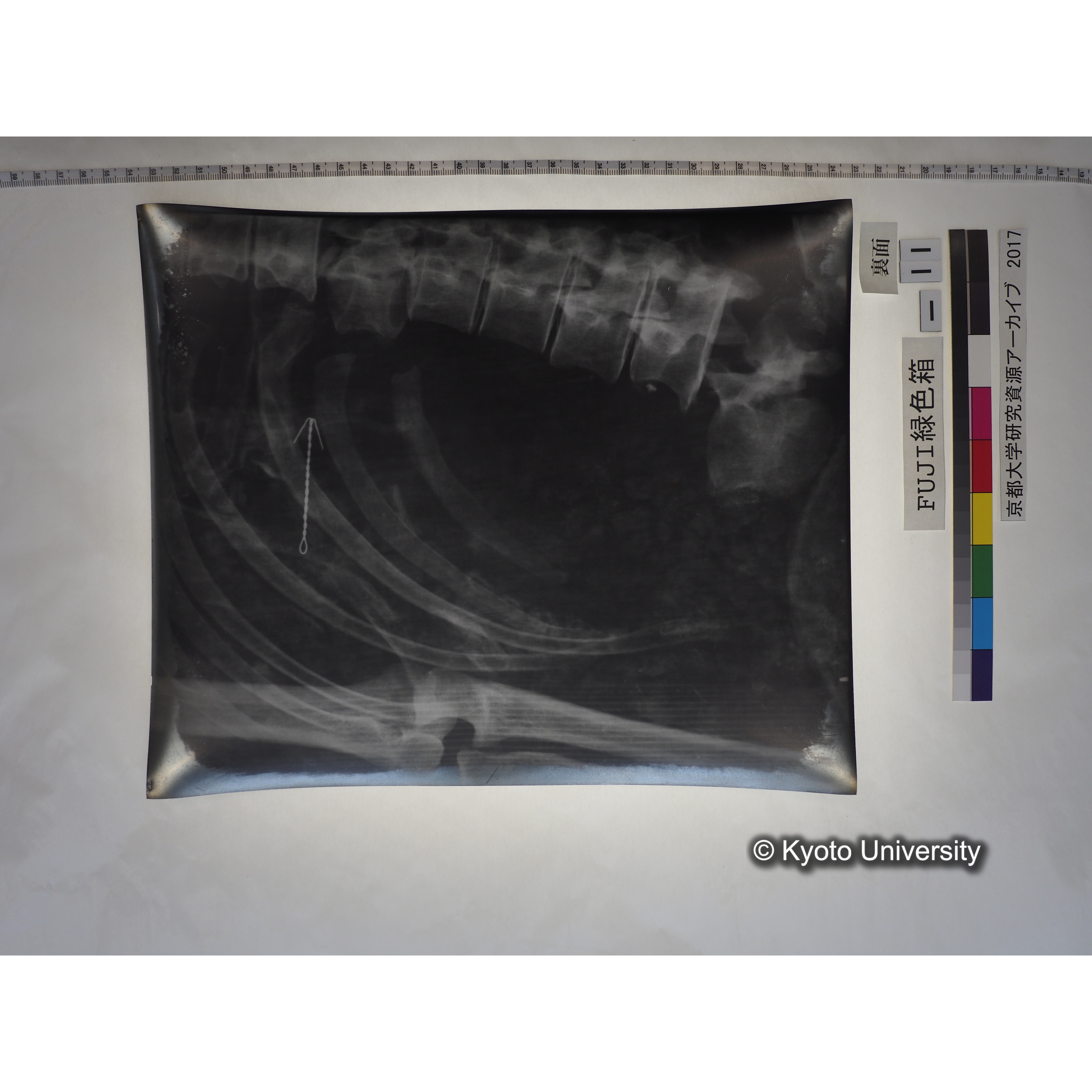 [フィルム] 胸部レントゲン (2)