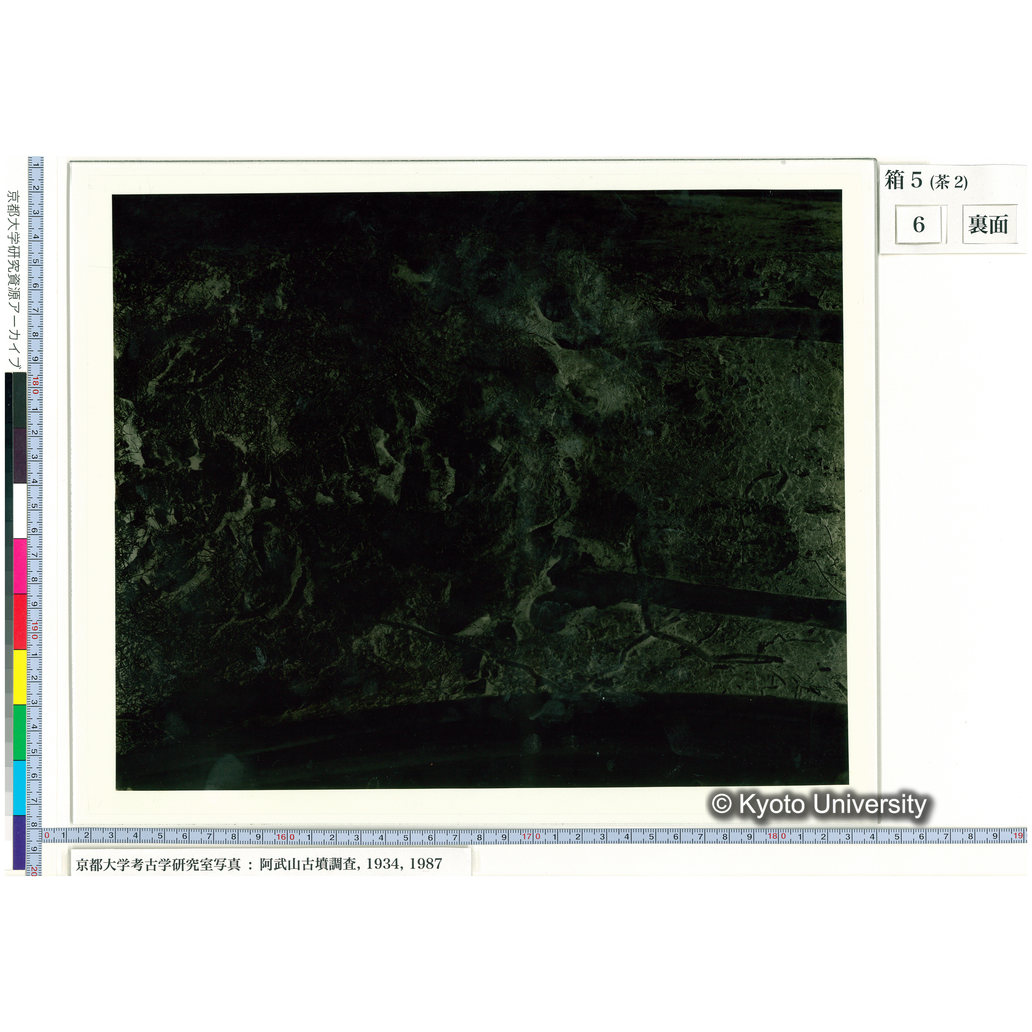 [乾板] 胸部から腰部 (2)