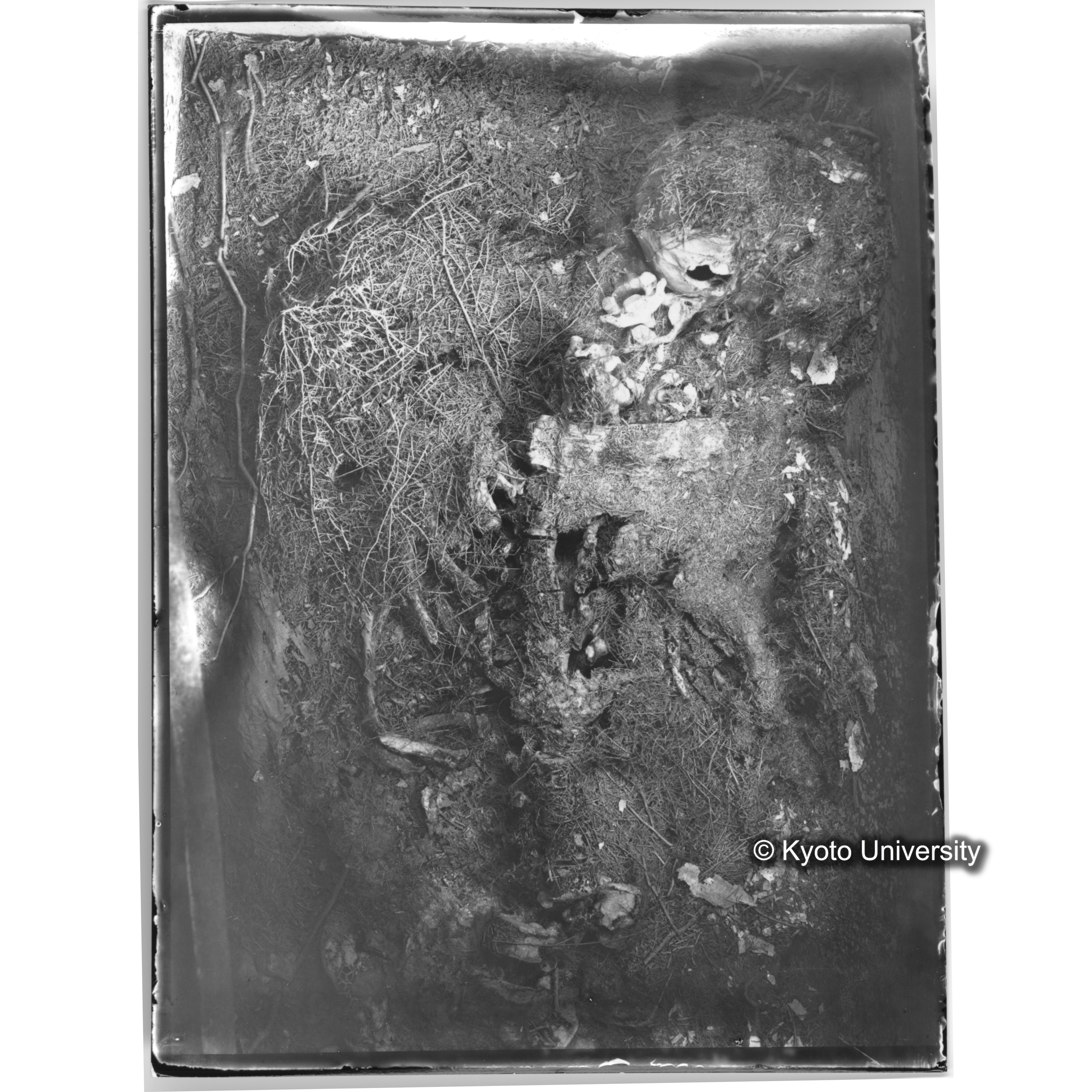 [プリント] 頭部から胸部 (1)