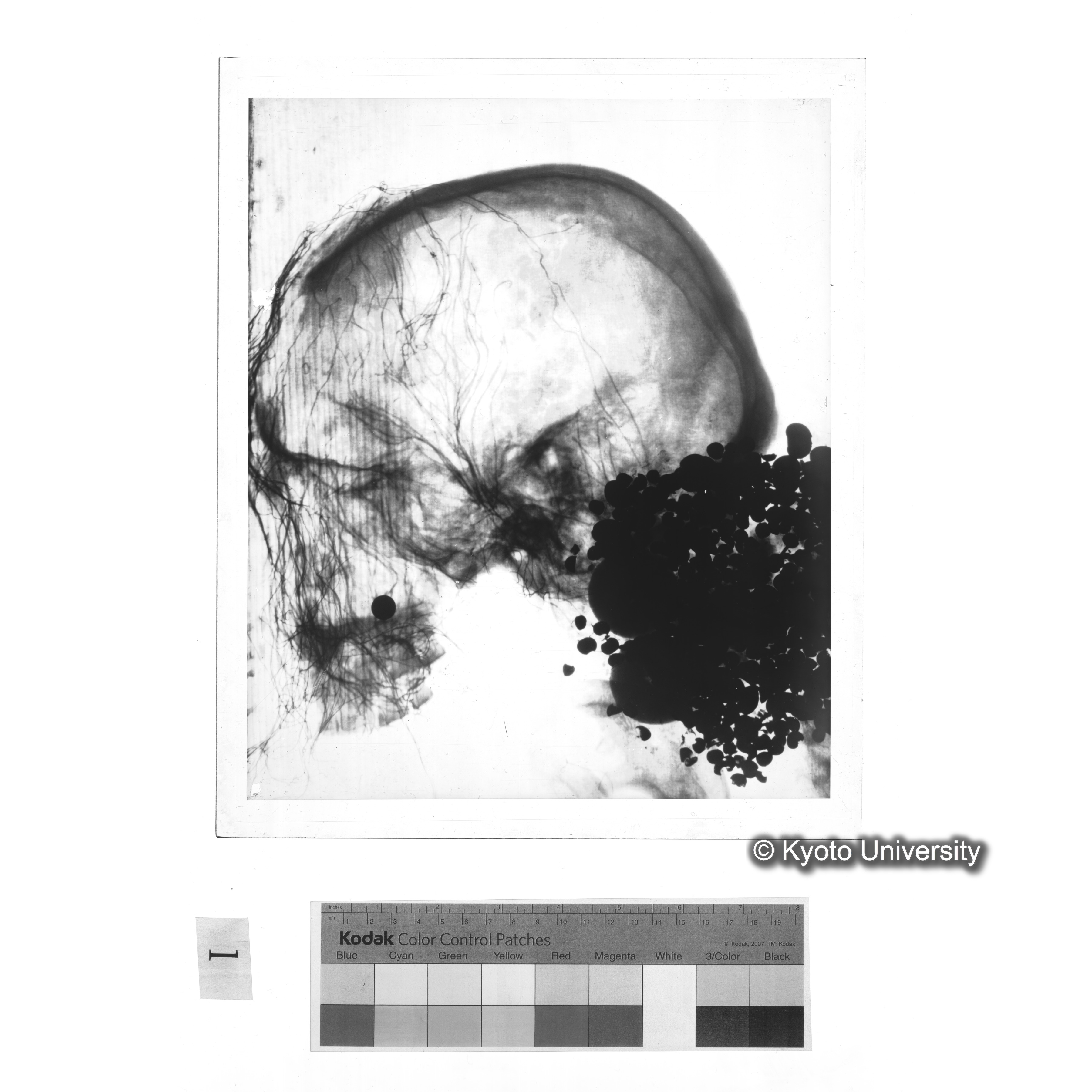 [写真内容] 頭部レントゲン１ (1)