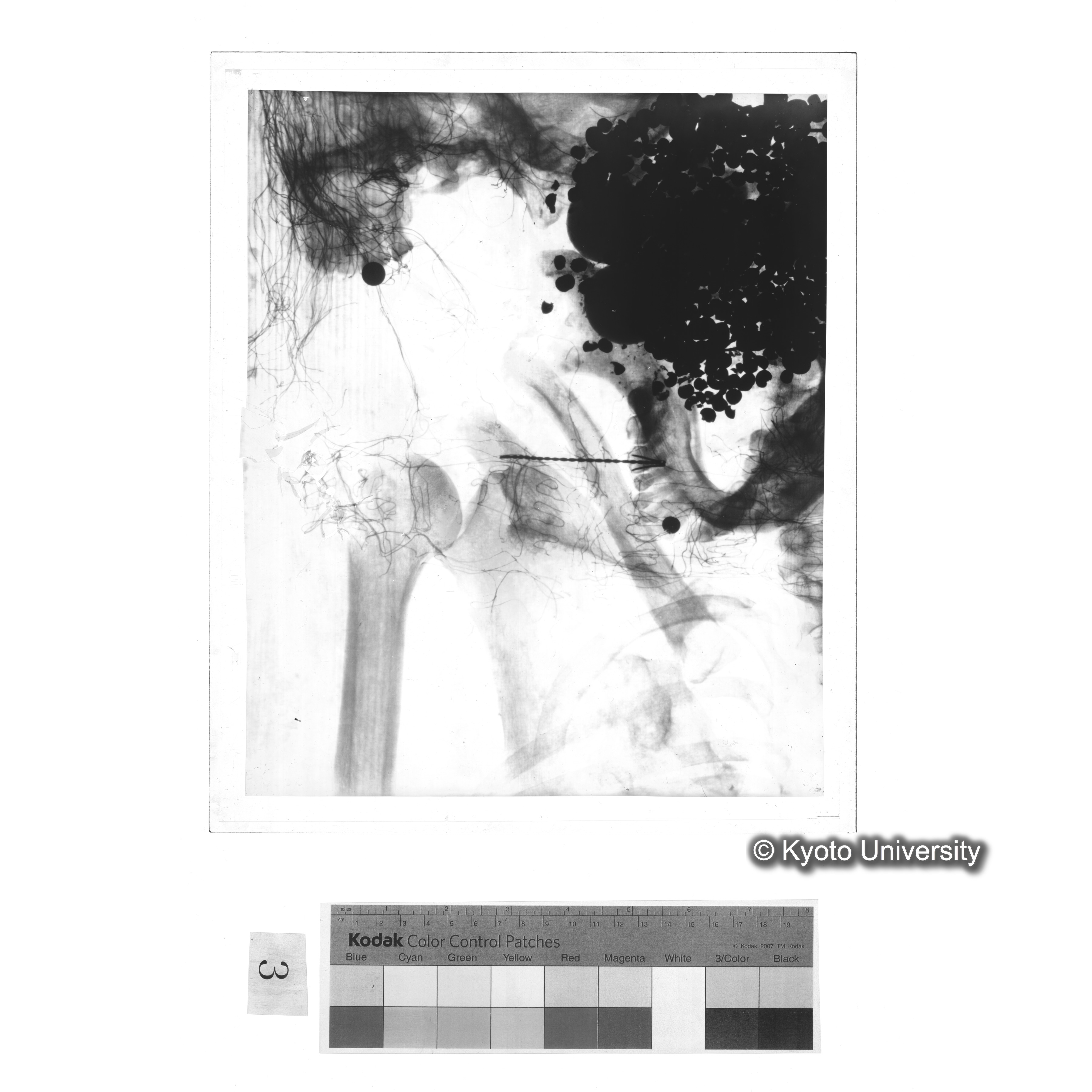 [写真内容] 顎部から胸部レントゲン (1)