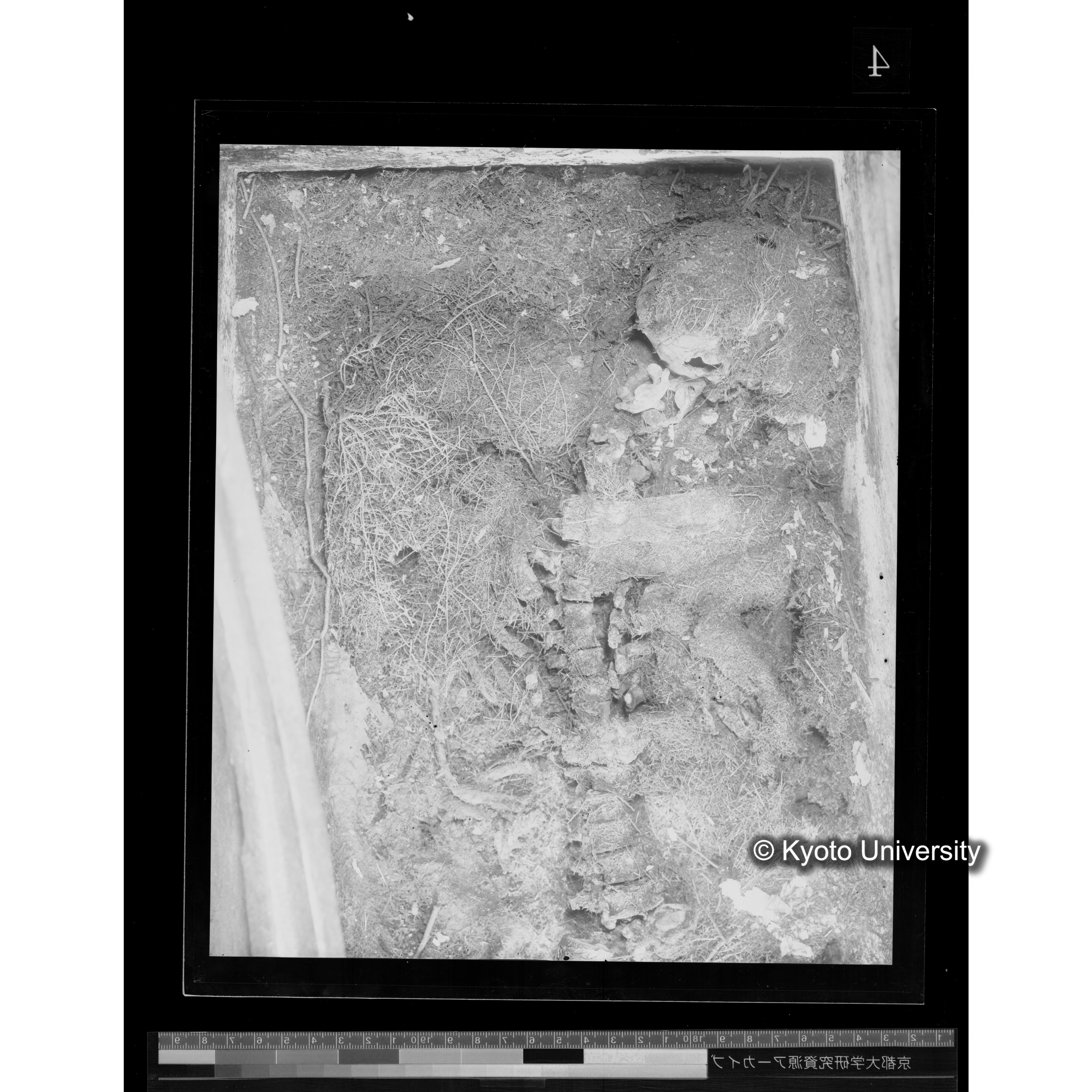 [写真内容] 頭部から胸部１ (2)