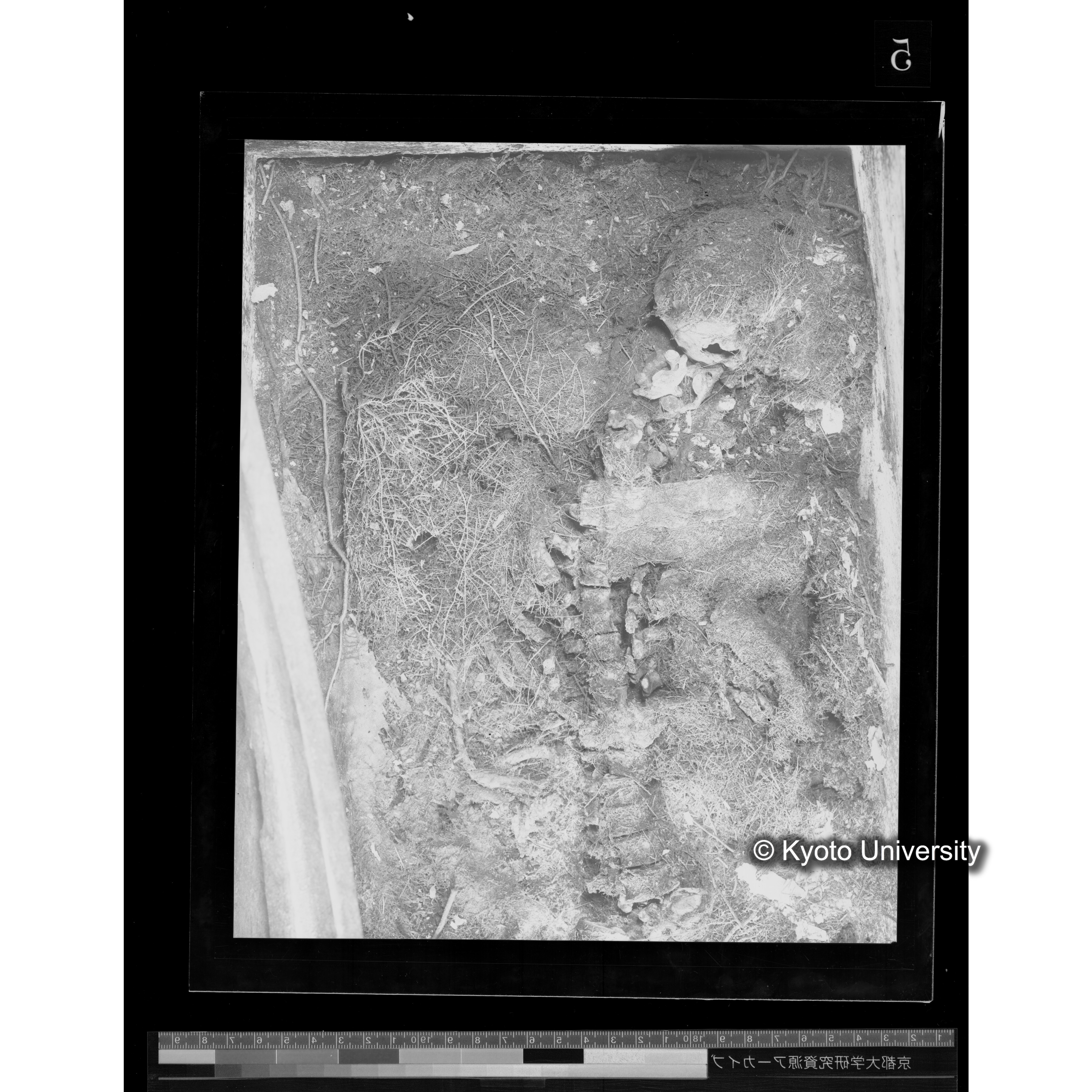 [写真内容] 頭部から胸部２ (2)