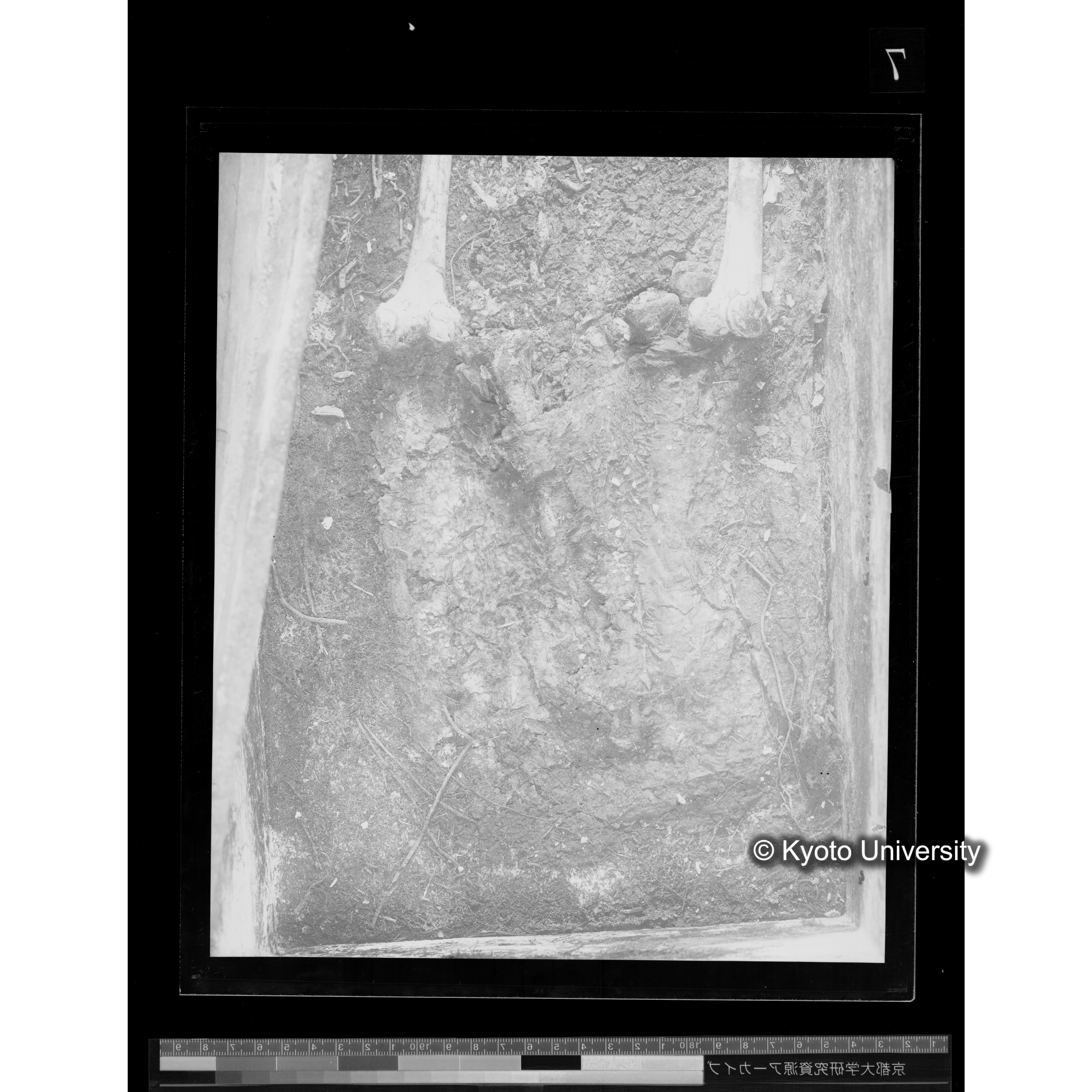 [写真内容] 足部 (2)