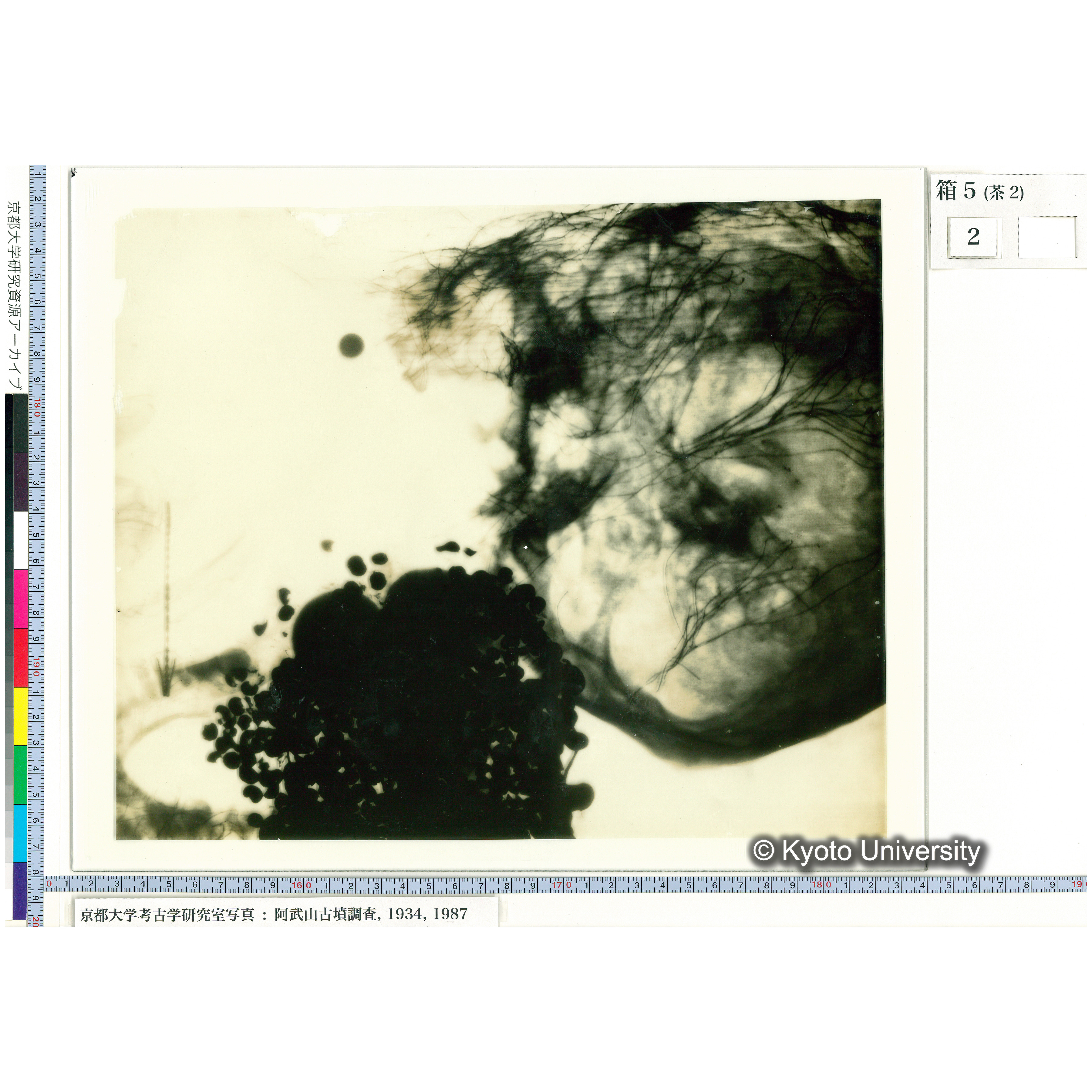 [乾板] 頭部レントゲン２ (1)