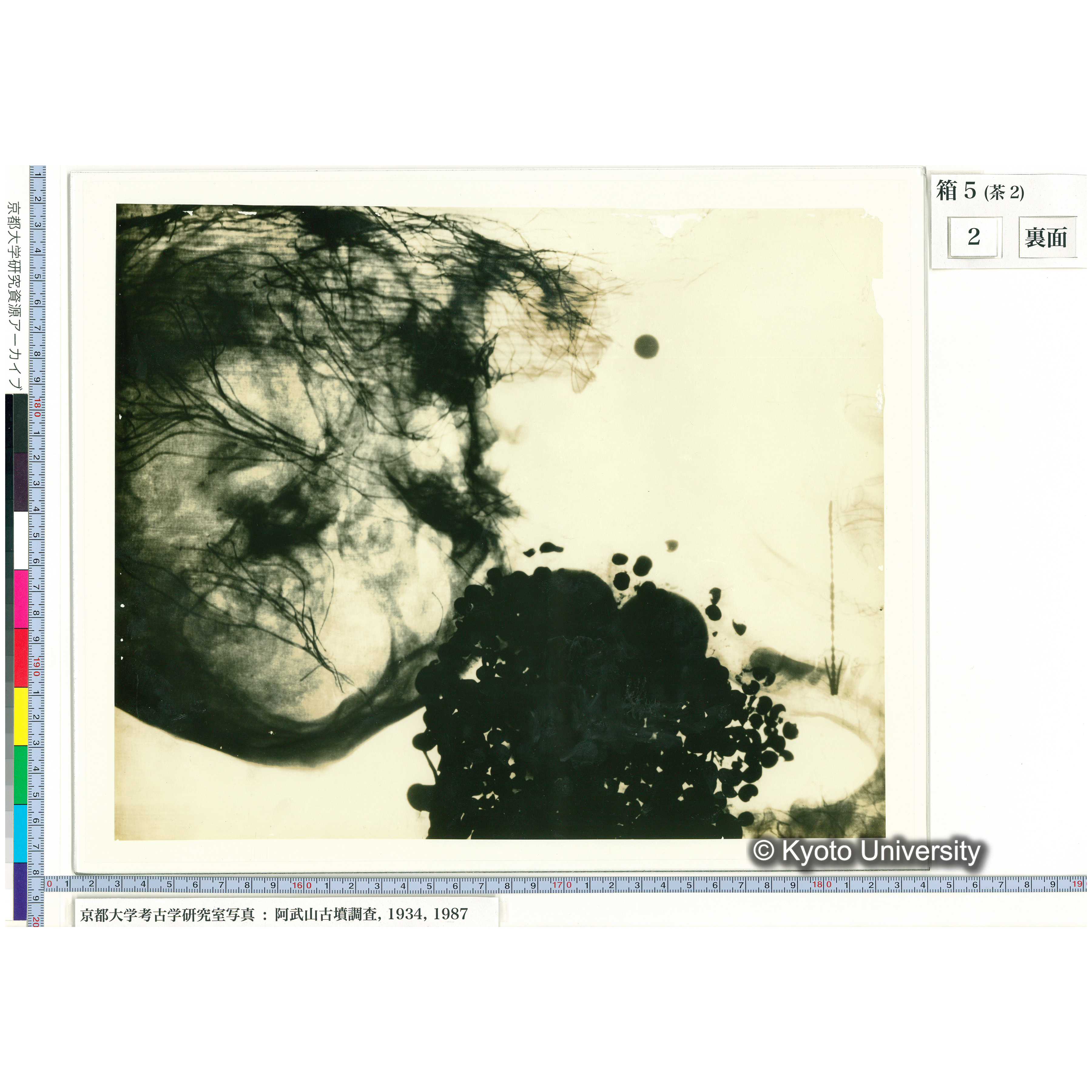 [乾板] 頭部レントゲン２ (2)