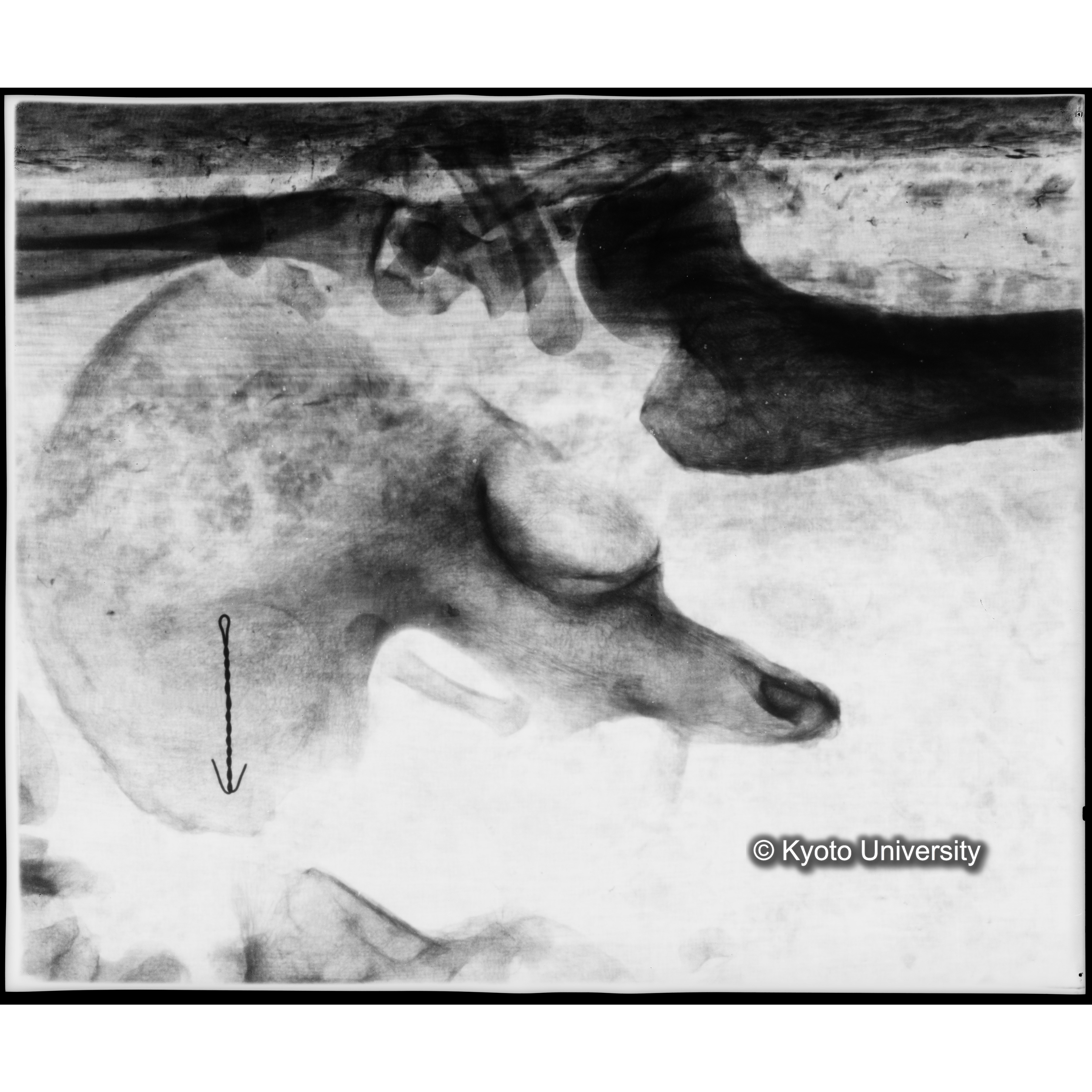 [写真内容] 腰部付近レントゲン (1)