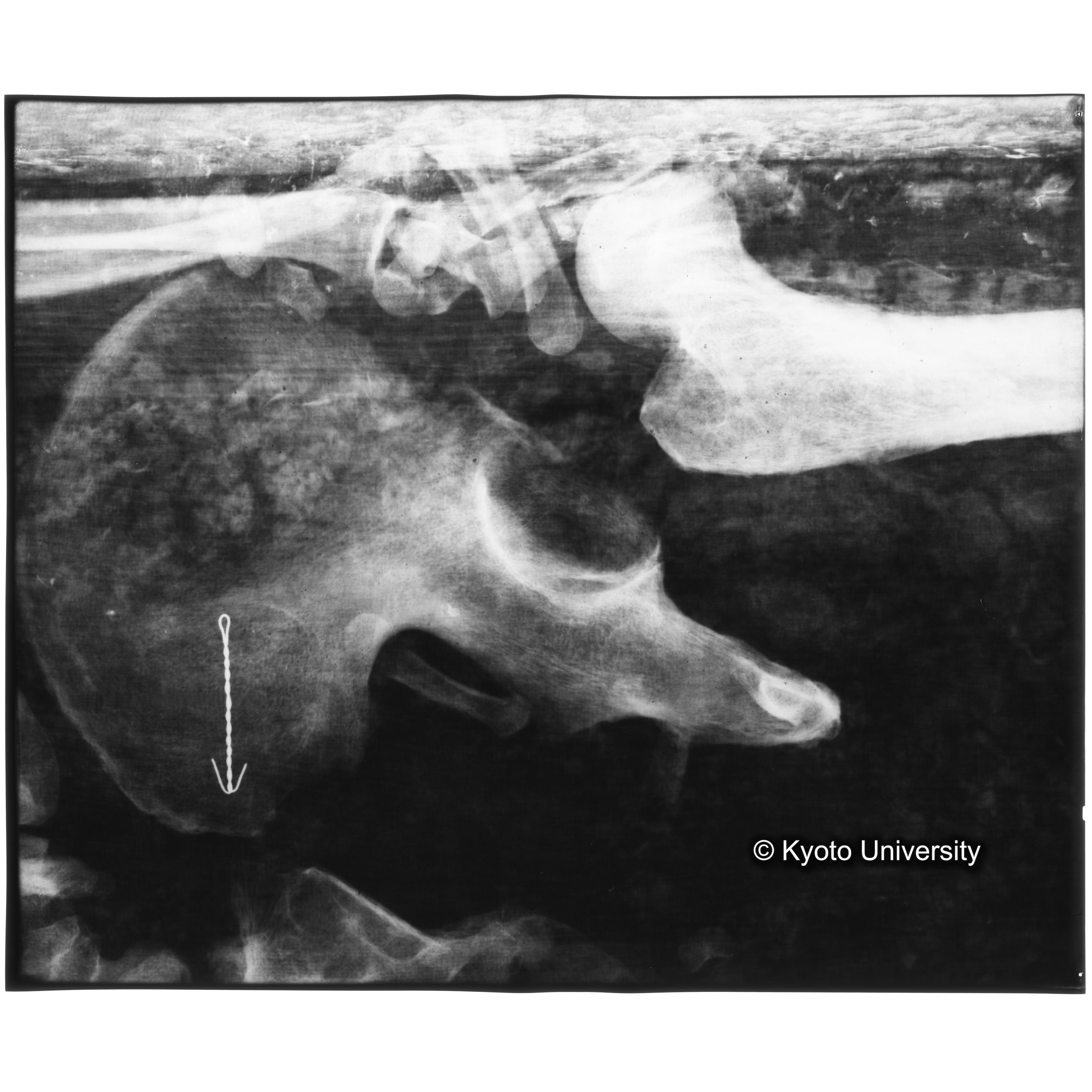 [写真内容] 腰部付近レントゲン (3)