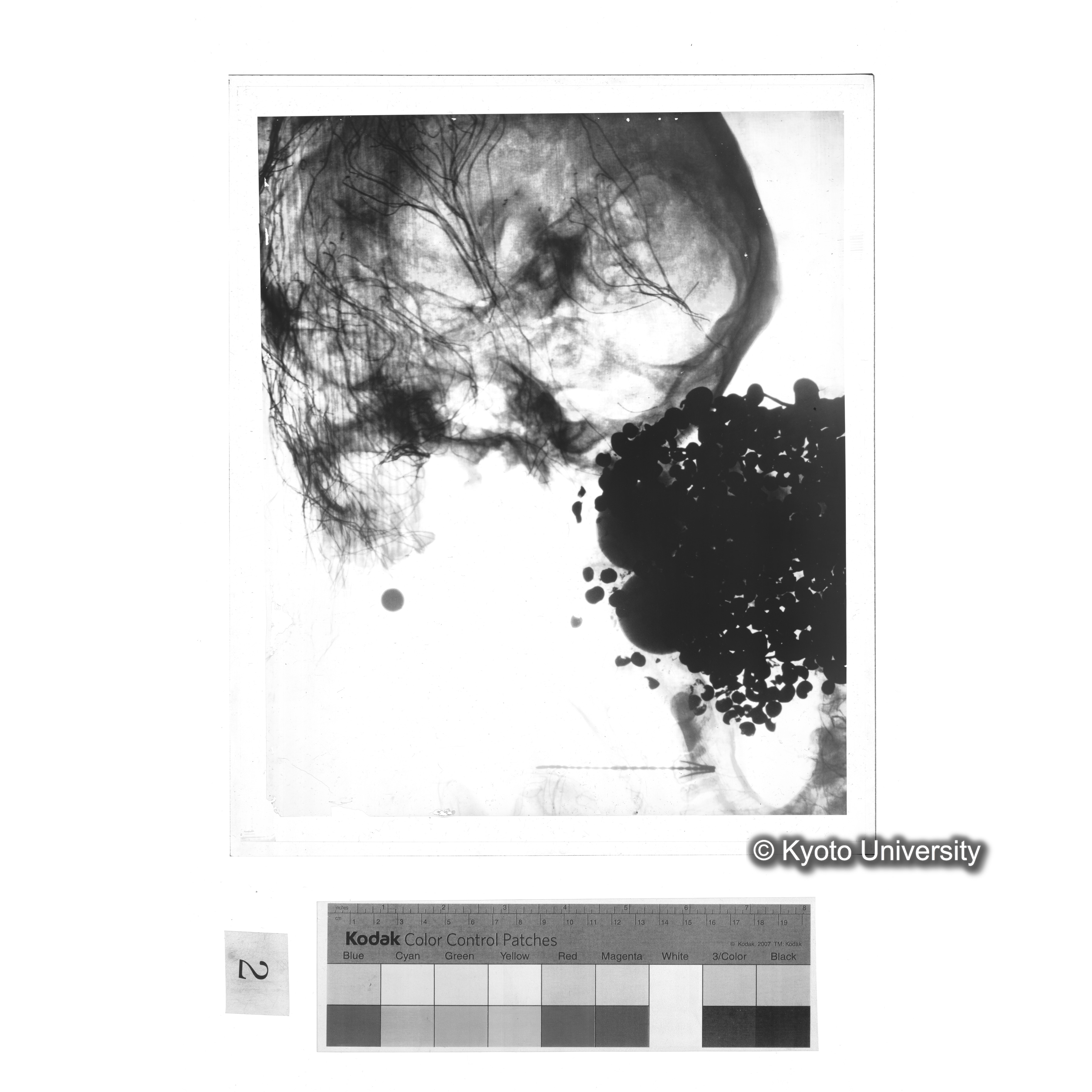 [写真内容] 頭部レントゲン２ (1)