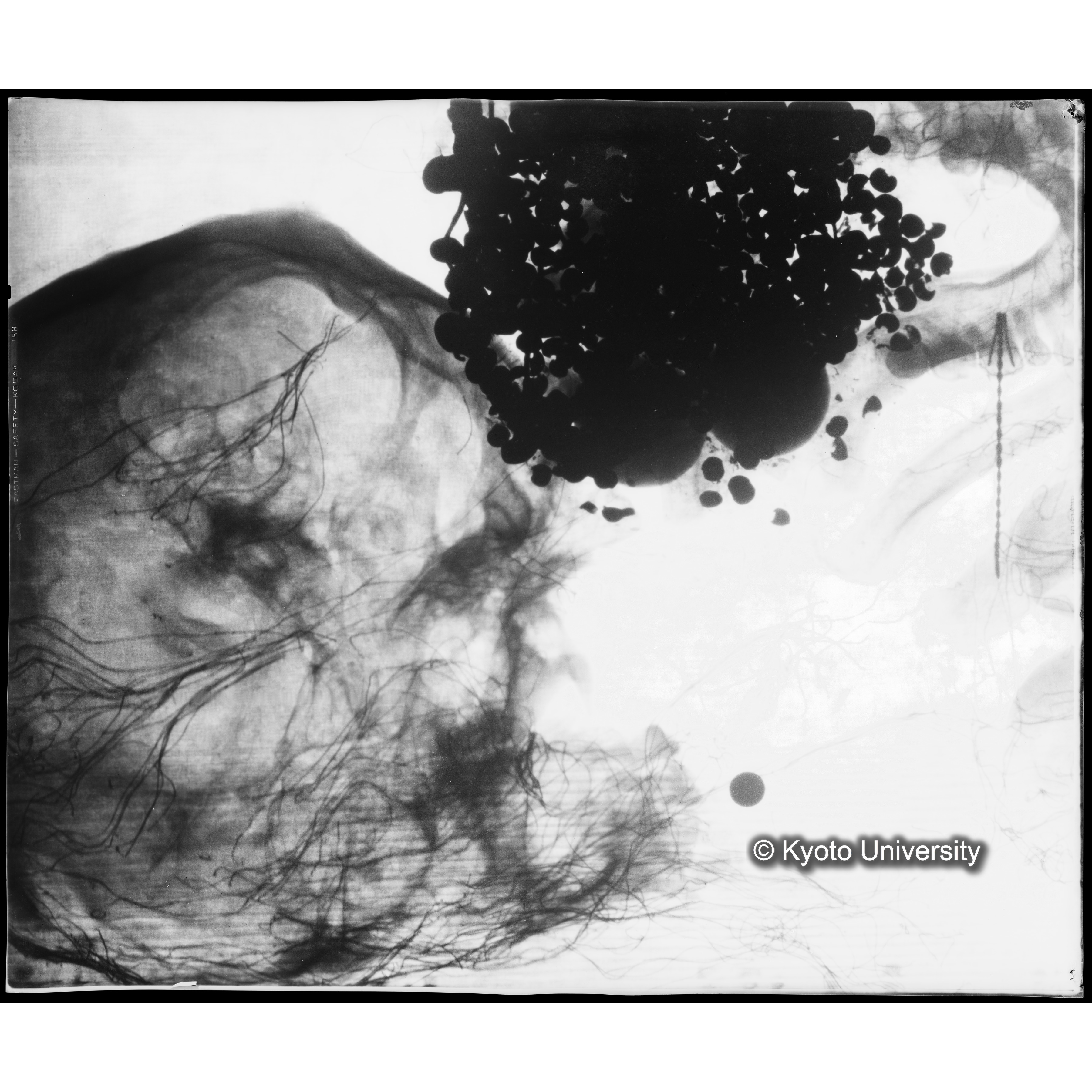 [写真内容] 頭部レントゲン２ (1)