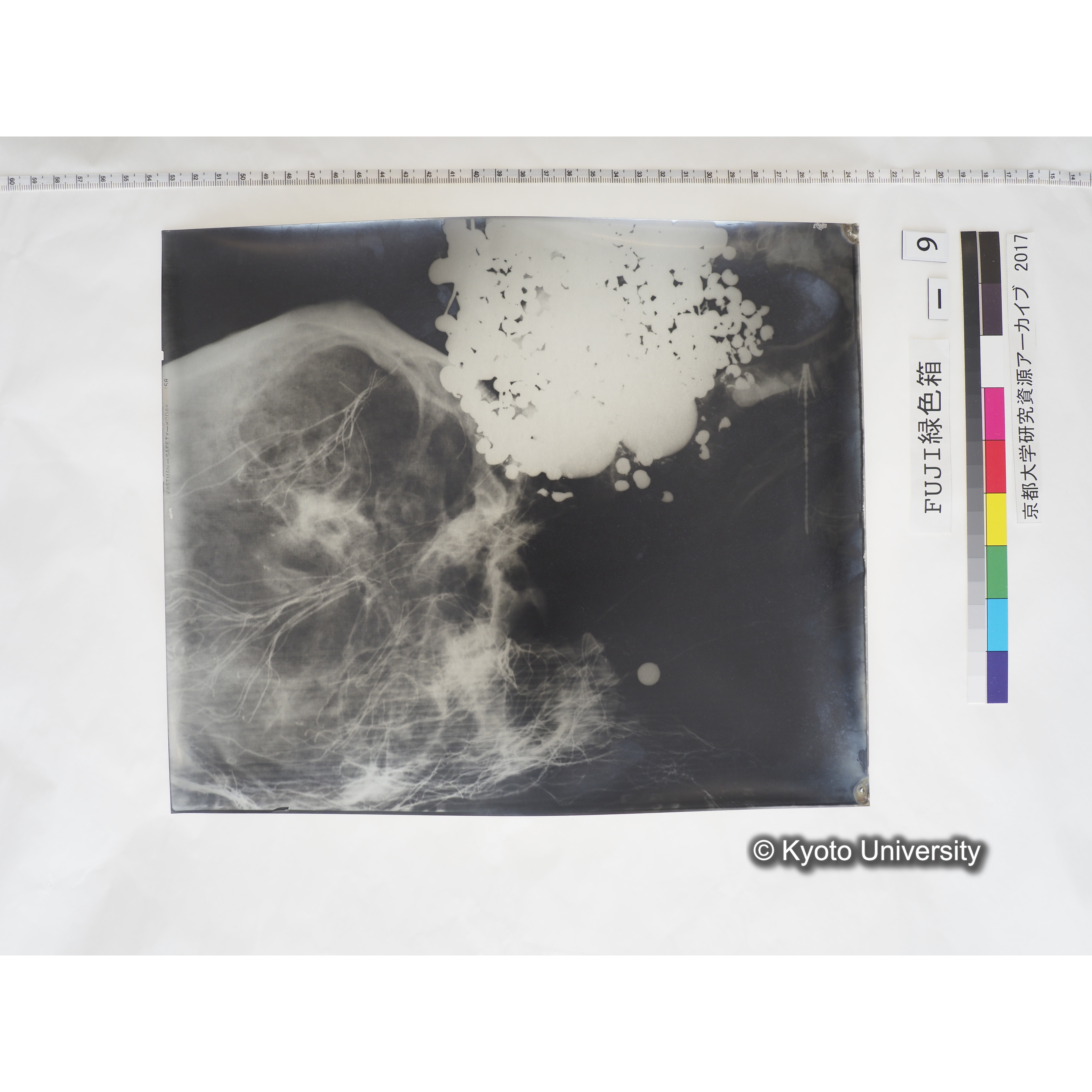 [フィルム] 頭部レントゲン２ (1)