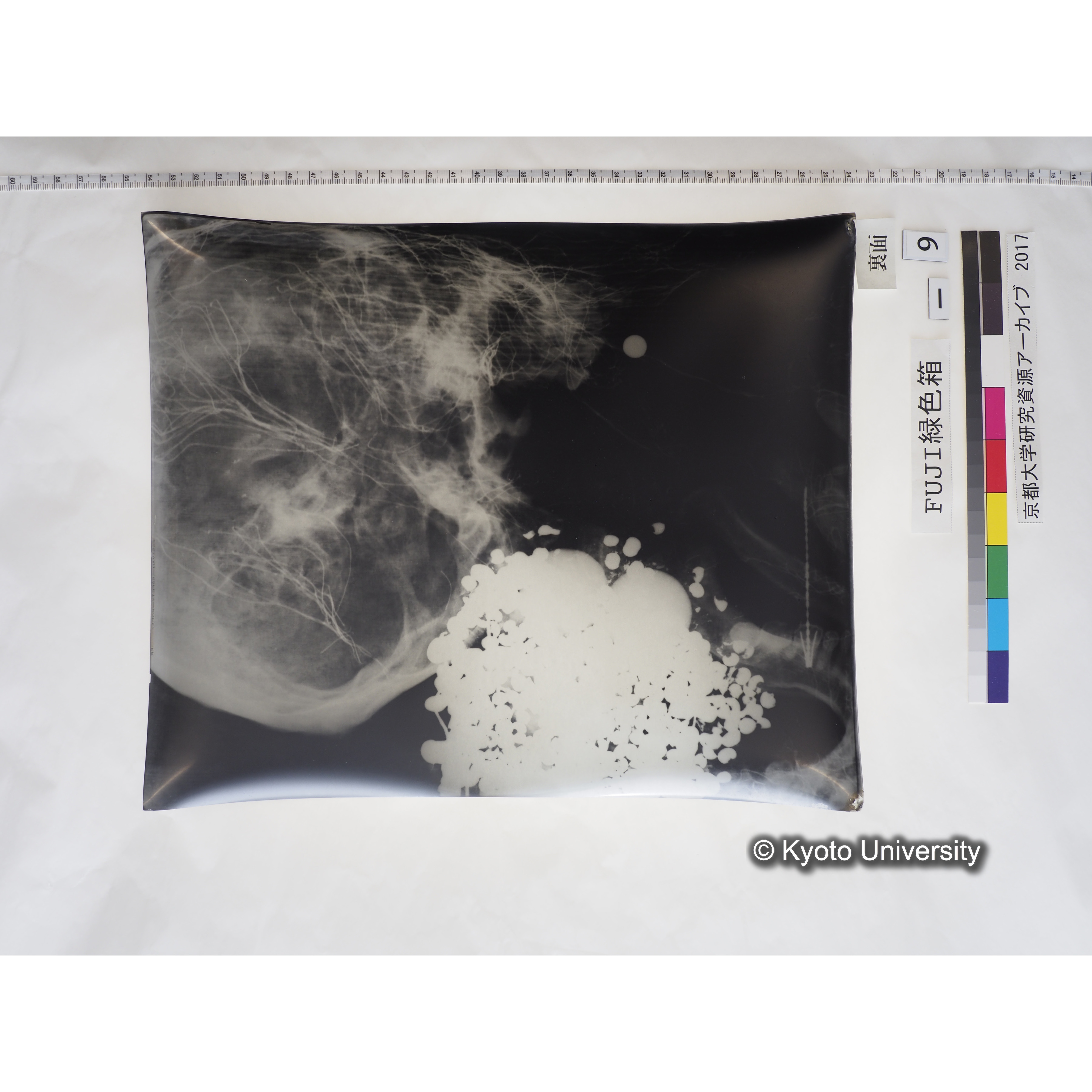 [フィルム] 頭部レントゲン２ (2)