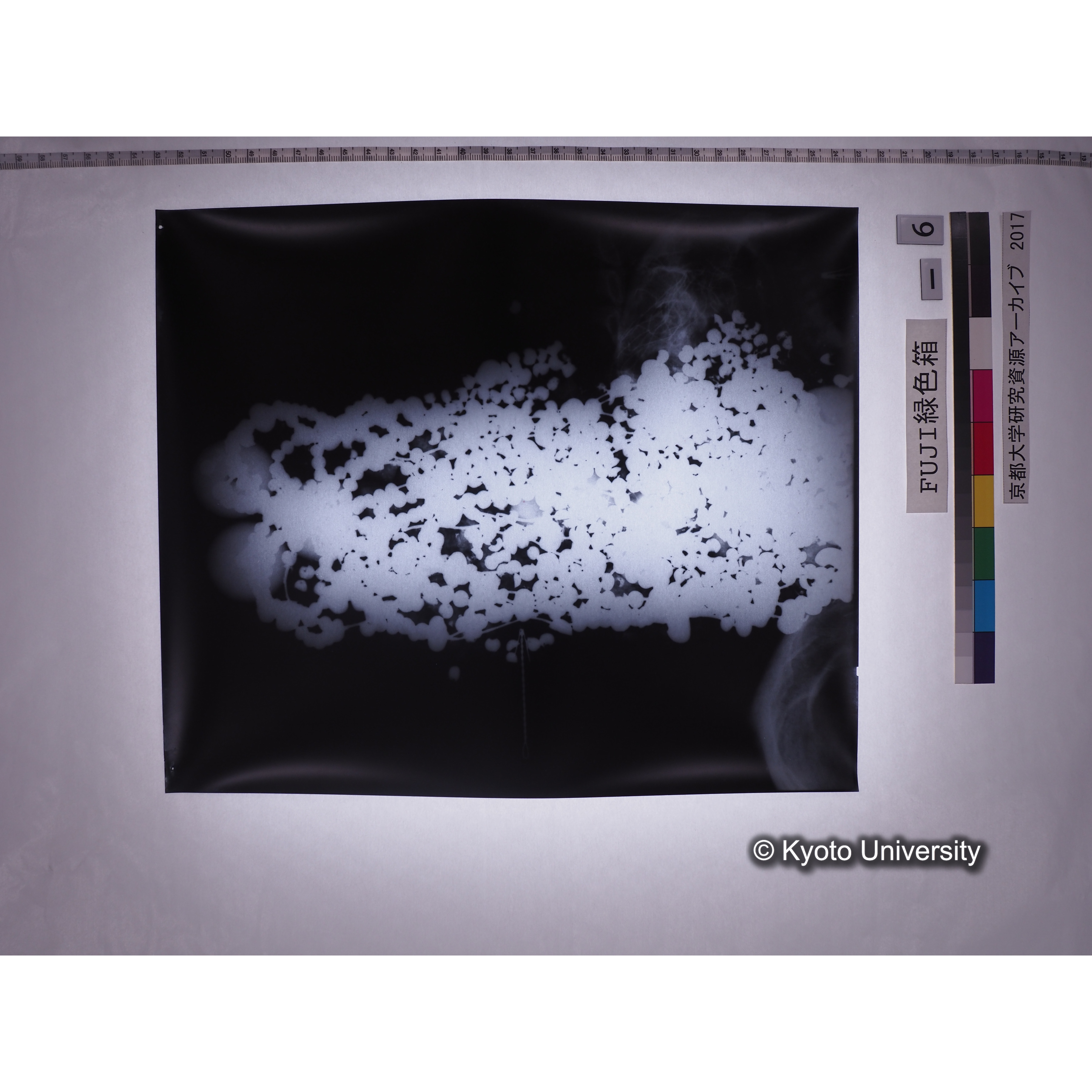 [フィルム] 玉枕レントゲン４ (1)