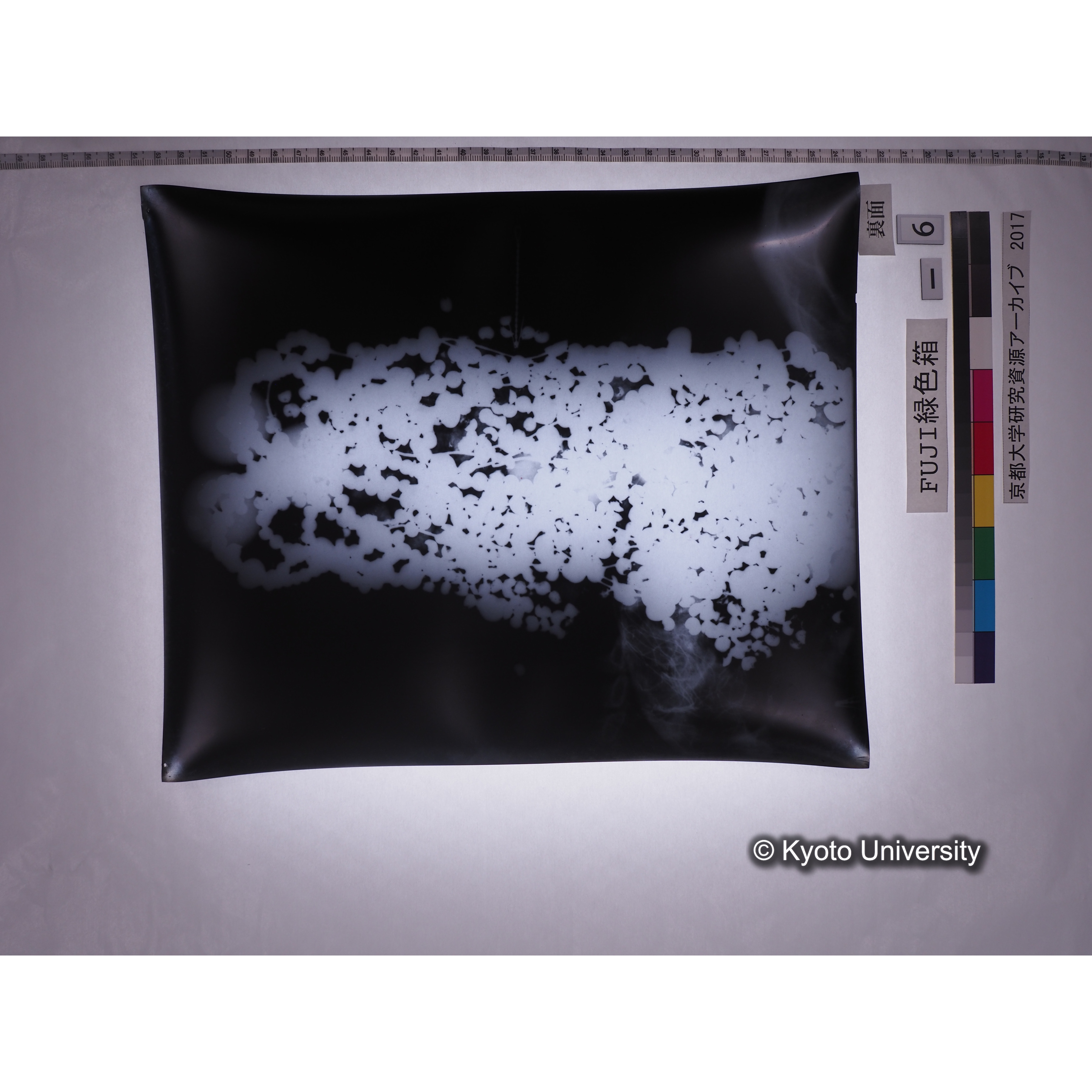 [フィルム] 玉枕レントゲン４ (2)