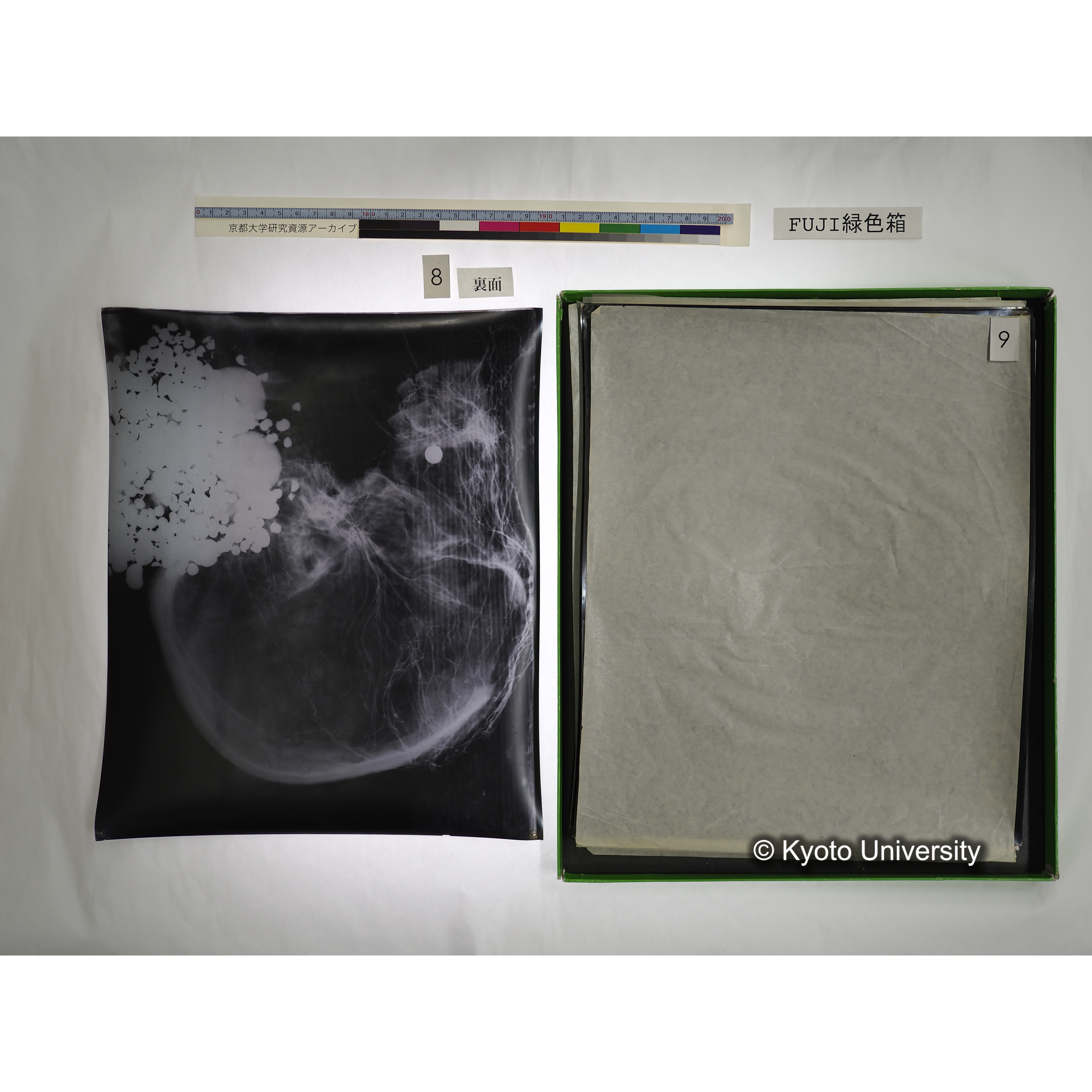 [FUJI PHOTO FILM 緑色箱] 阿武山古墳遺体 レントゲン写真 No.3 (17)