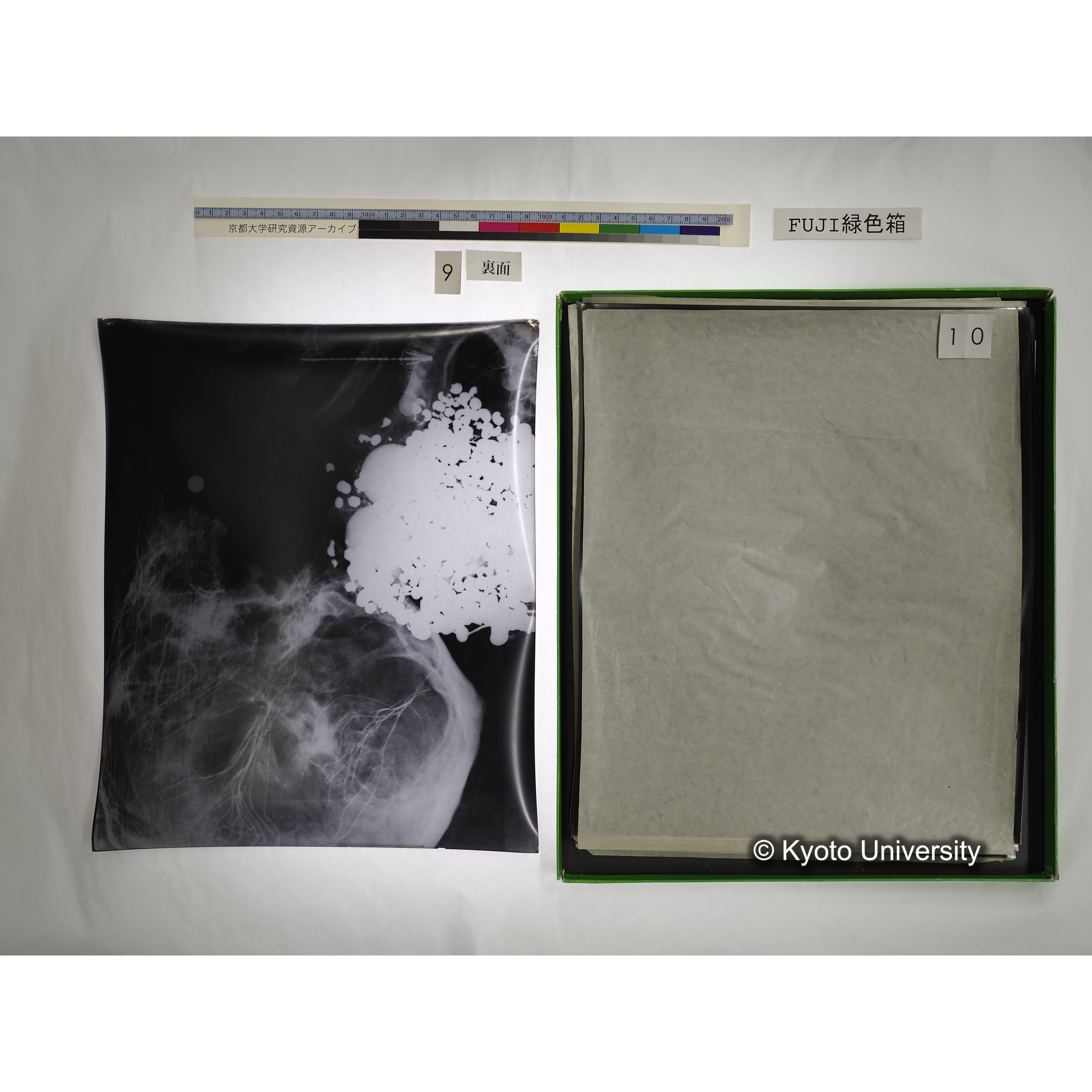 [FUJI PHOTO FILM 緑色箱] 阿武山古墳遺体 レントゲン写真 No.3 (19)