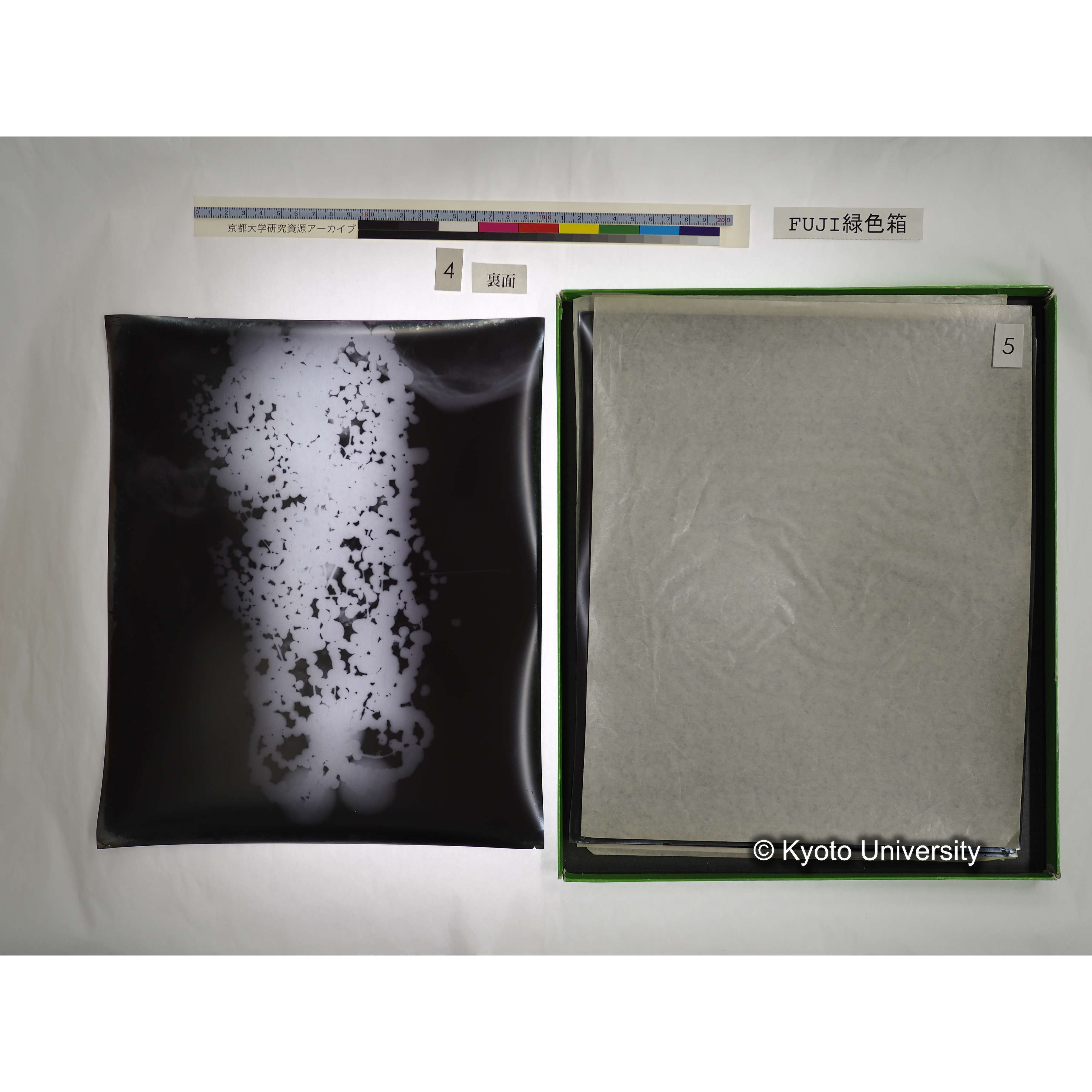 [FUJI PHOTO FILM 緑色箱] 阿武山古墳遺体 レントゲン写真 No.3 (25)