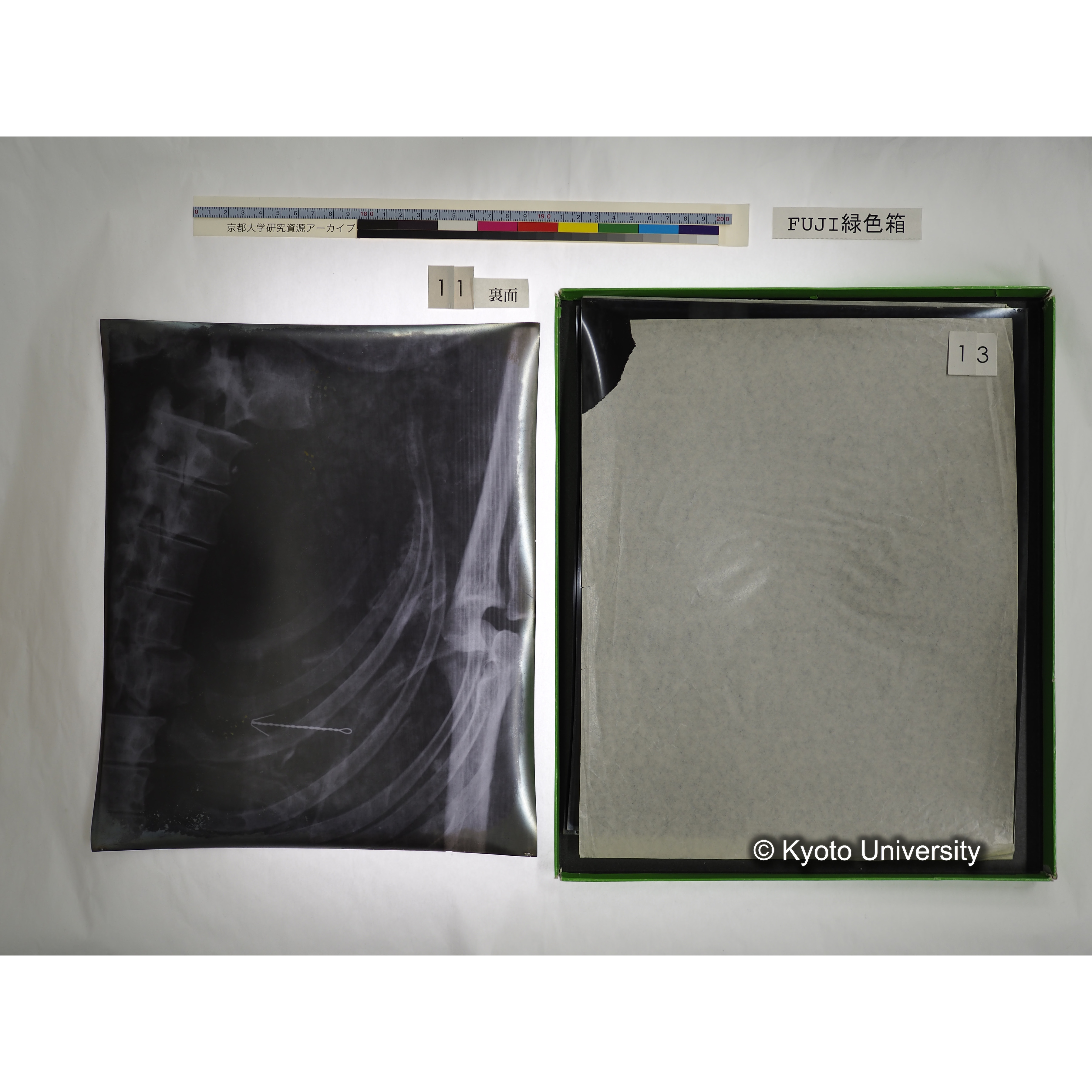 [FUJI PHOTO FILM 緑色箱] 阿武山古墳遺体 レントゲン写真 No.3 (31)