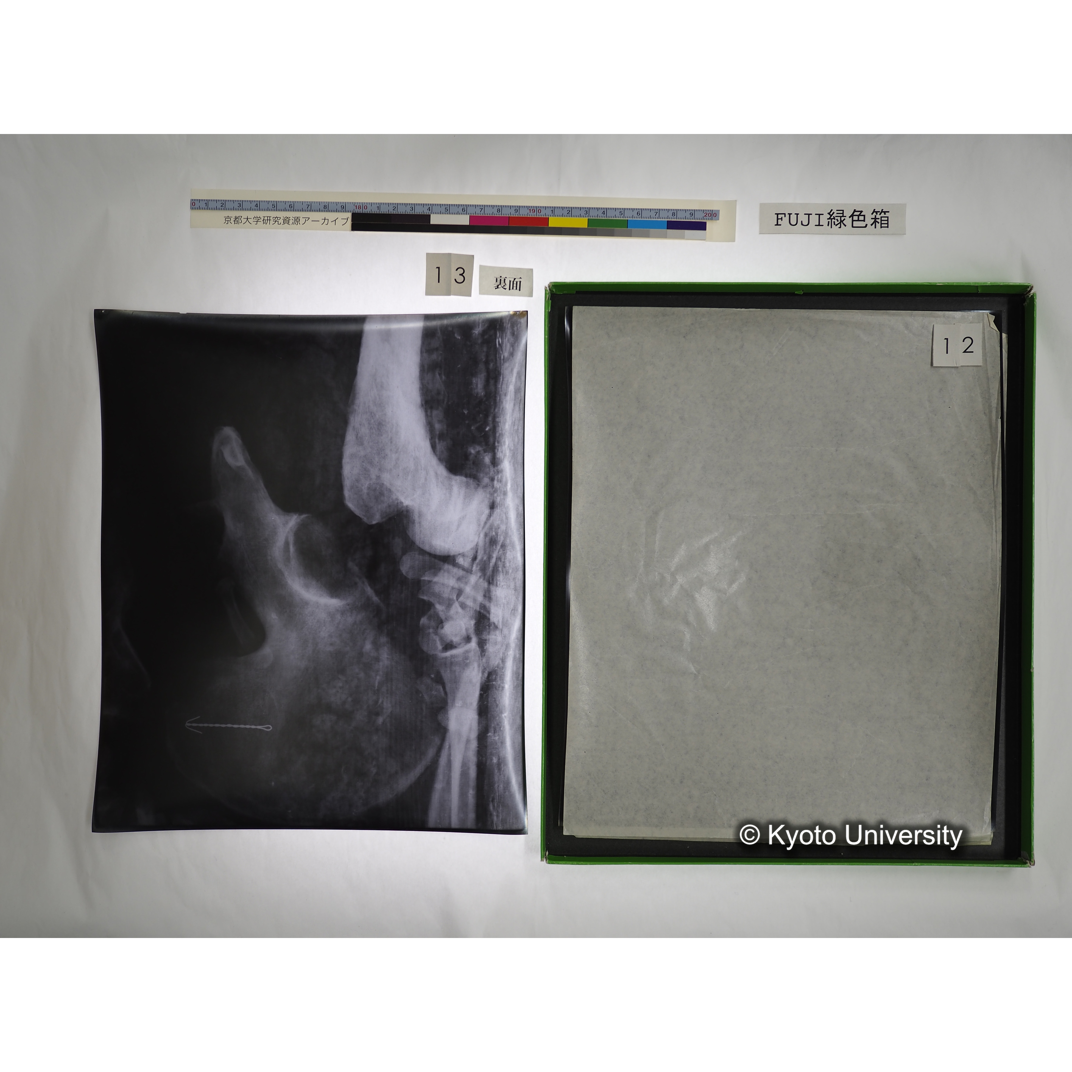 [FUJI PHOTO FILM 緑色箱] 阿武山古墳遺体 レントゲン写真 No.3 (33)