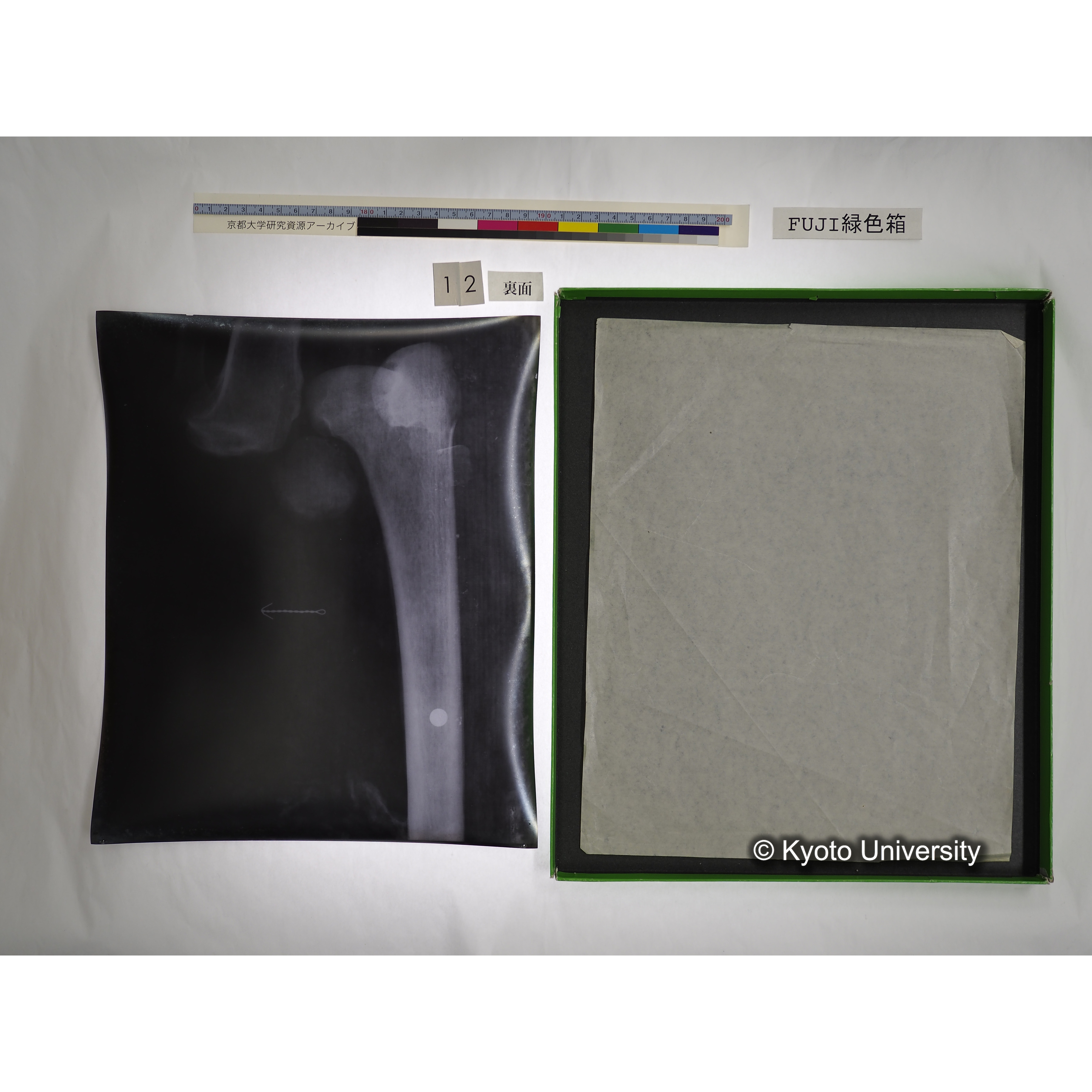 [FUJI PHOTO FILM 緑色箱] 阿武山古墳遺体 レントゲン写真 No.3 (35)