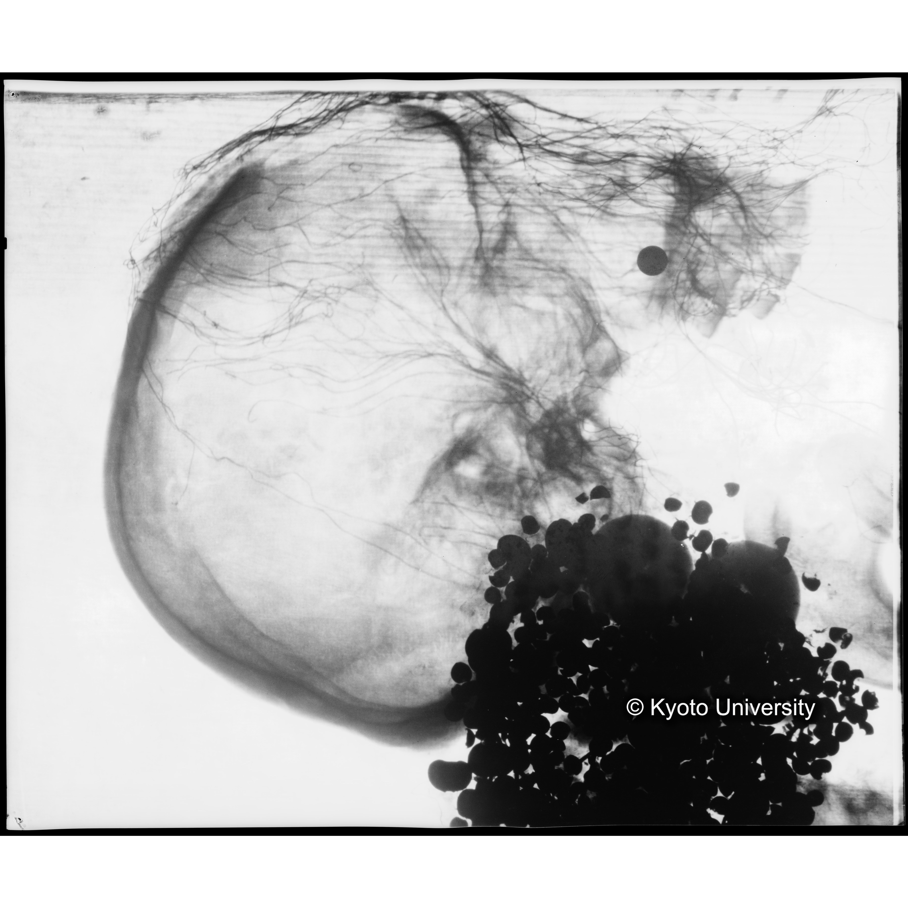 [写真内容] 頭部レントゲン１ (1)