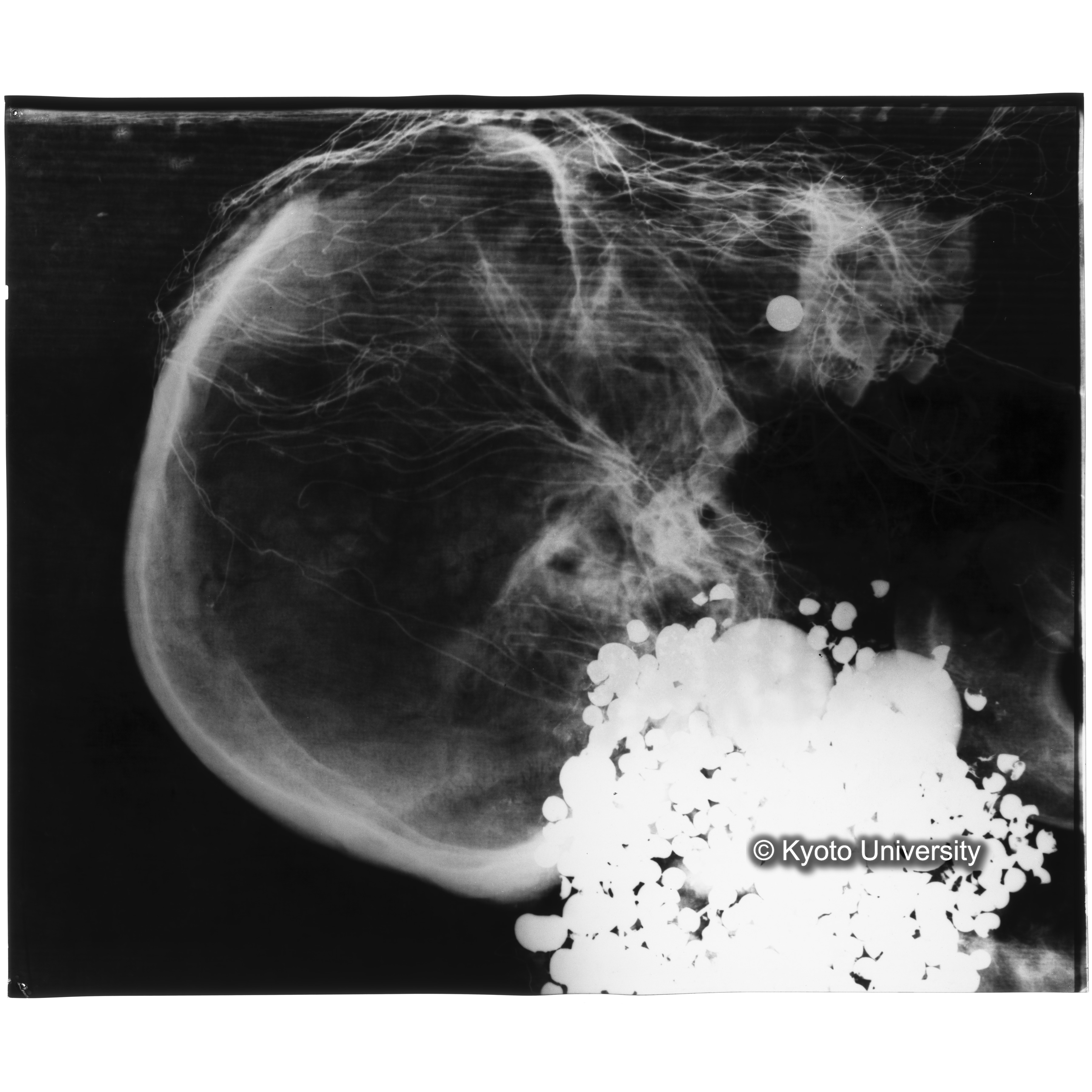 [写真内容] 頭部レントゲン１ (3)