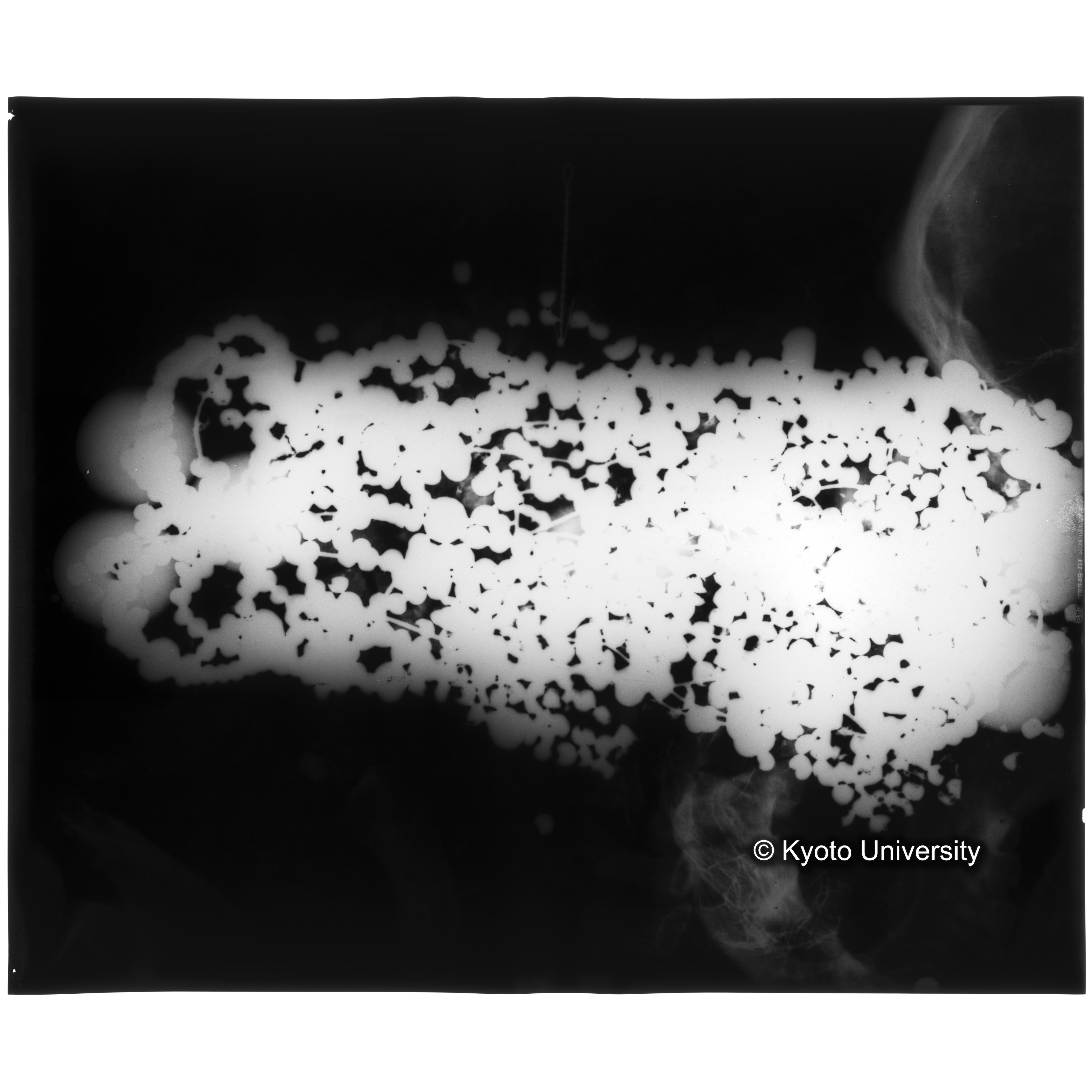 [写真内容] 玉枕レントゲン２ (3)