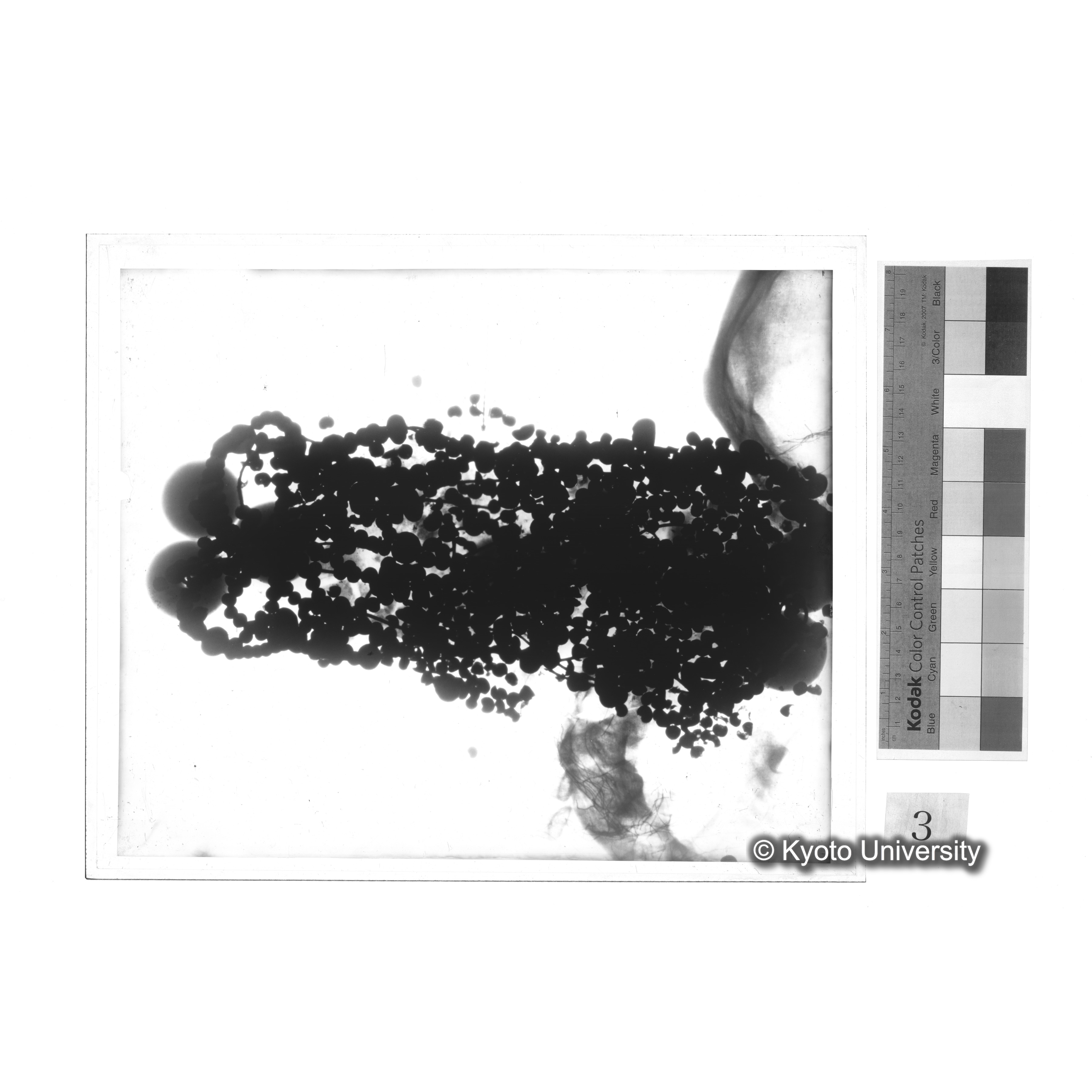 [写真内容] 玉枕レントゲン２ (1)