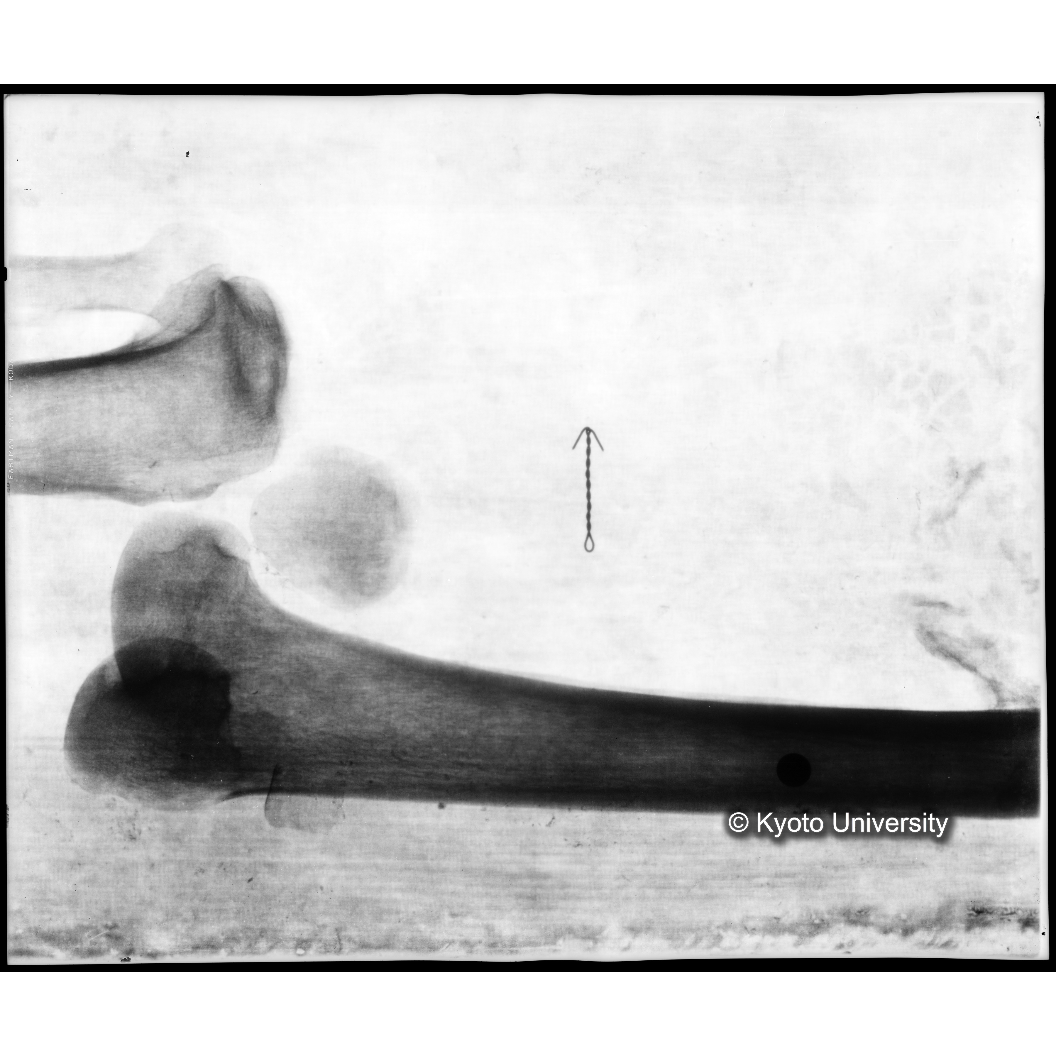 [写真内容] 足部レントゲン (1)