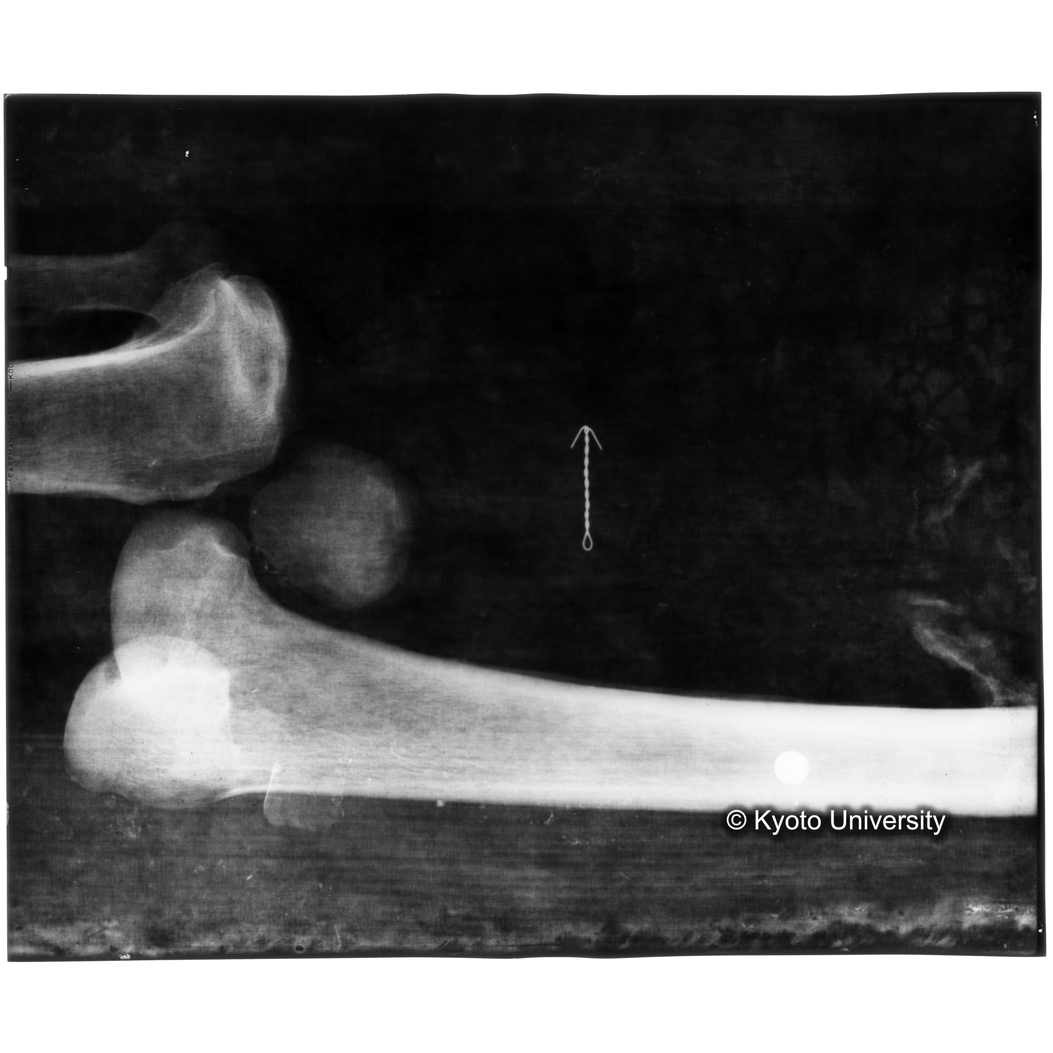 [写真内容] 足部レントゲン (3)