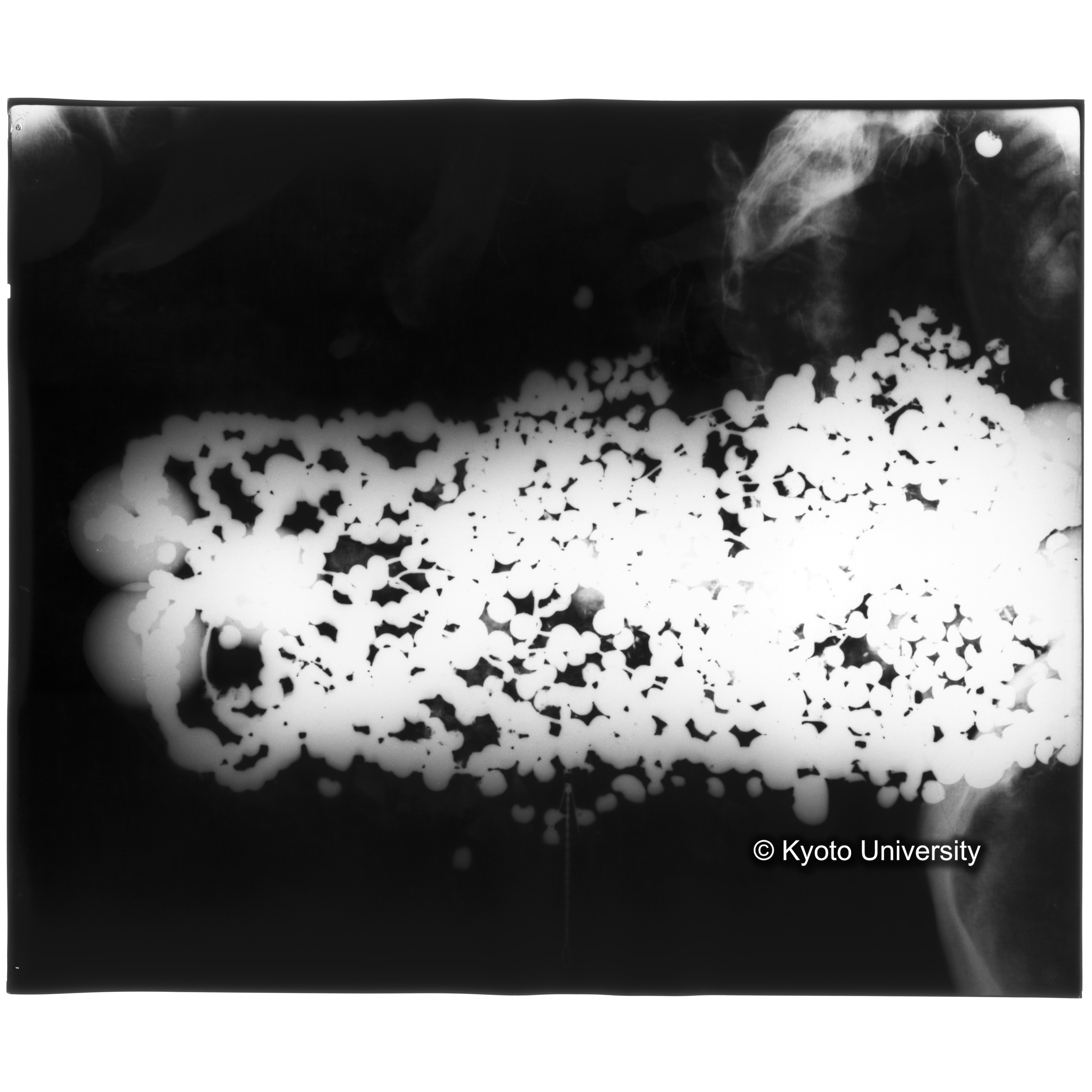 [写真内容] 玉枕レントゲン３ (3)