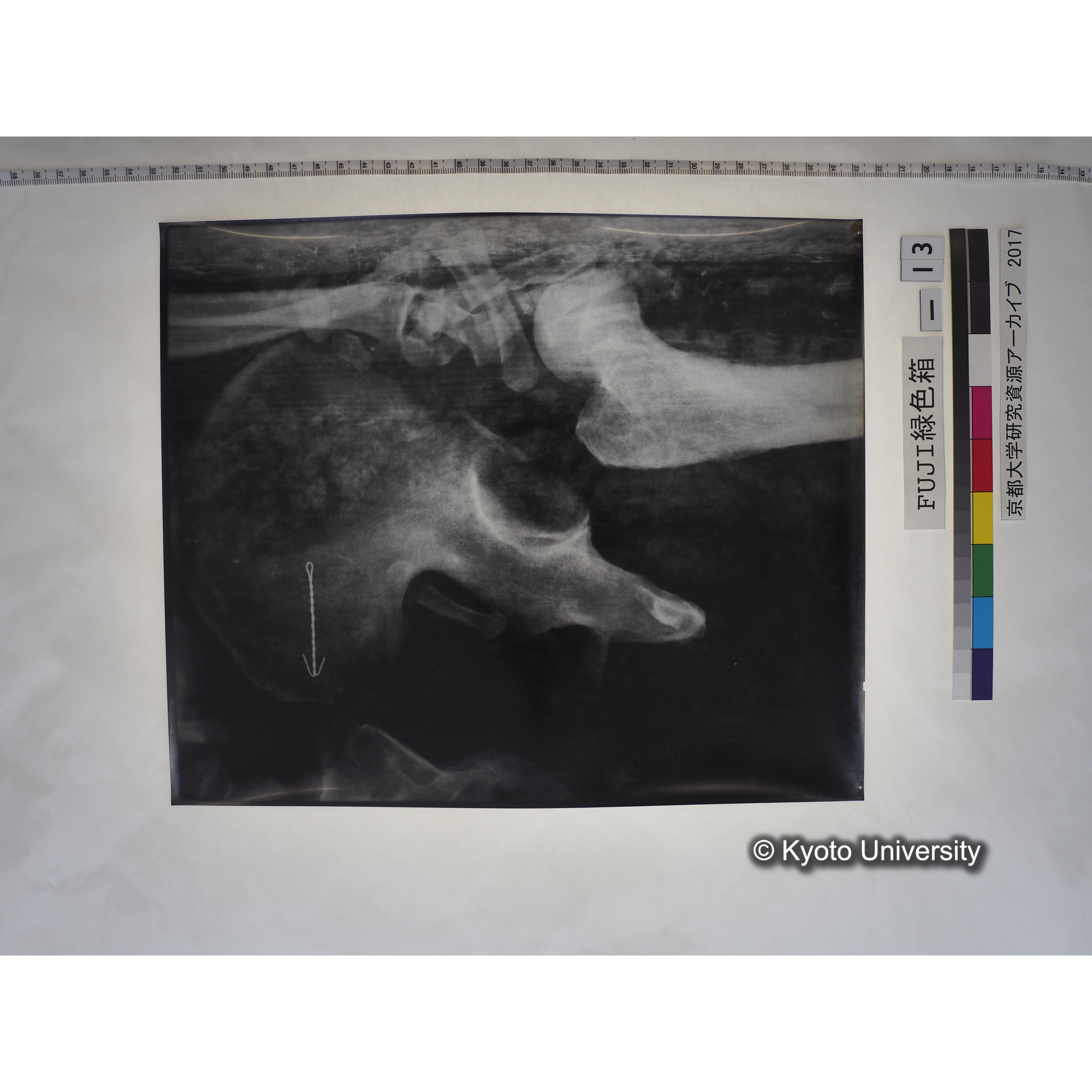 [フィルム] 腰部付近レントゲン (1)