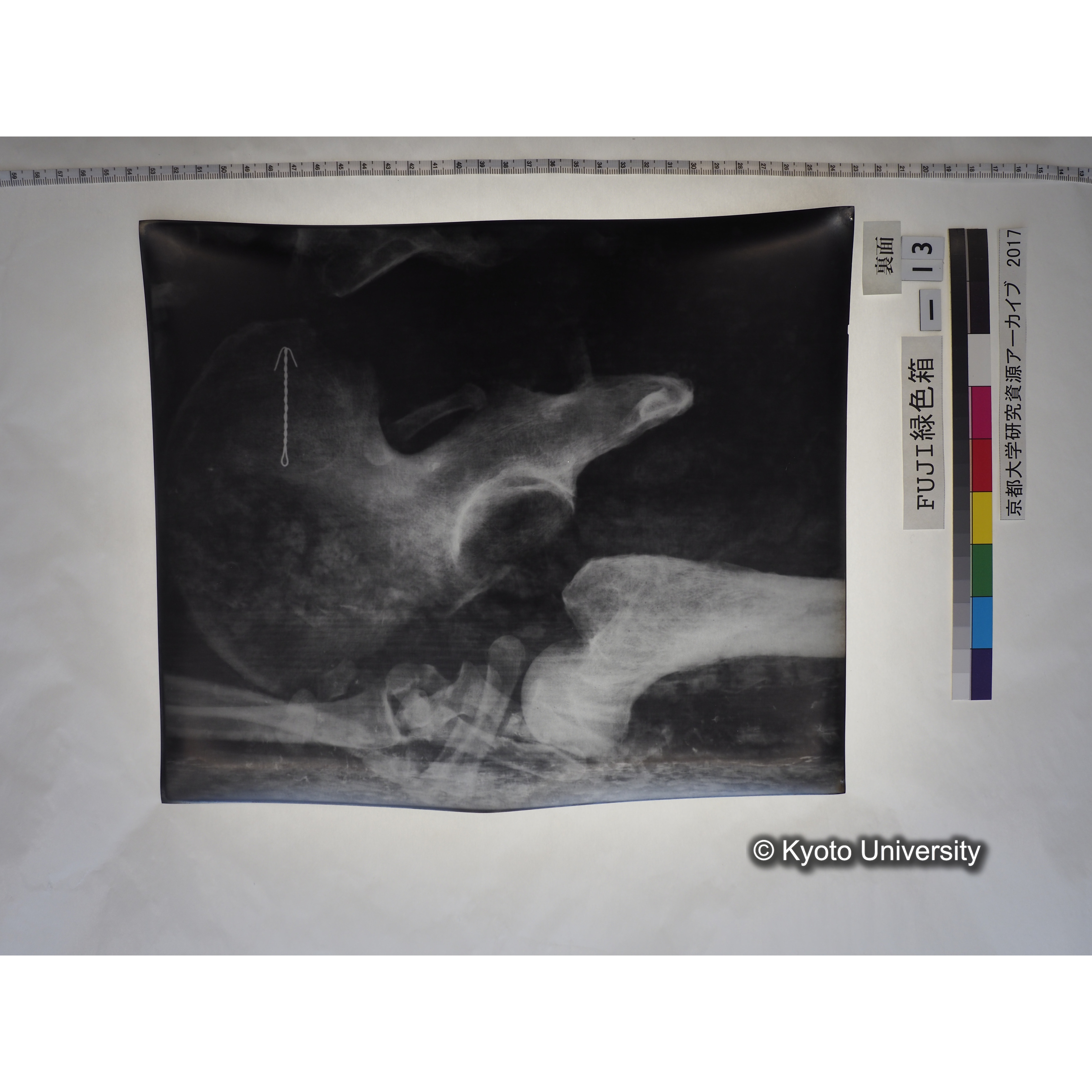 [フィルム] 腰部付近レントゲン (2)