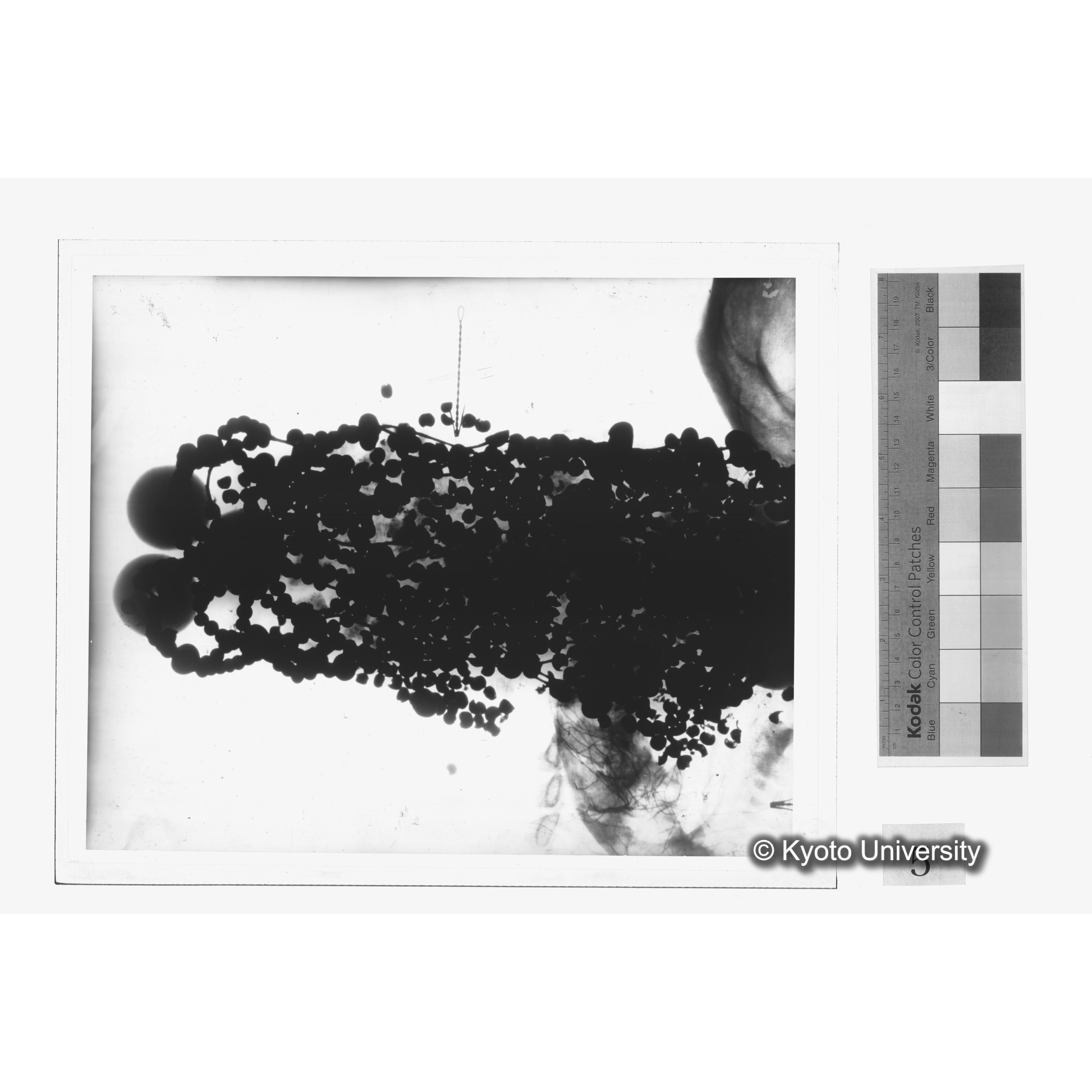 [写真内容] 玉枕レントゲン４ (1)