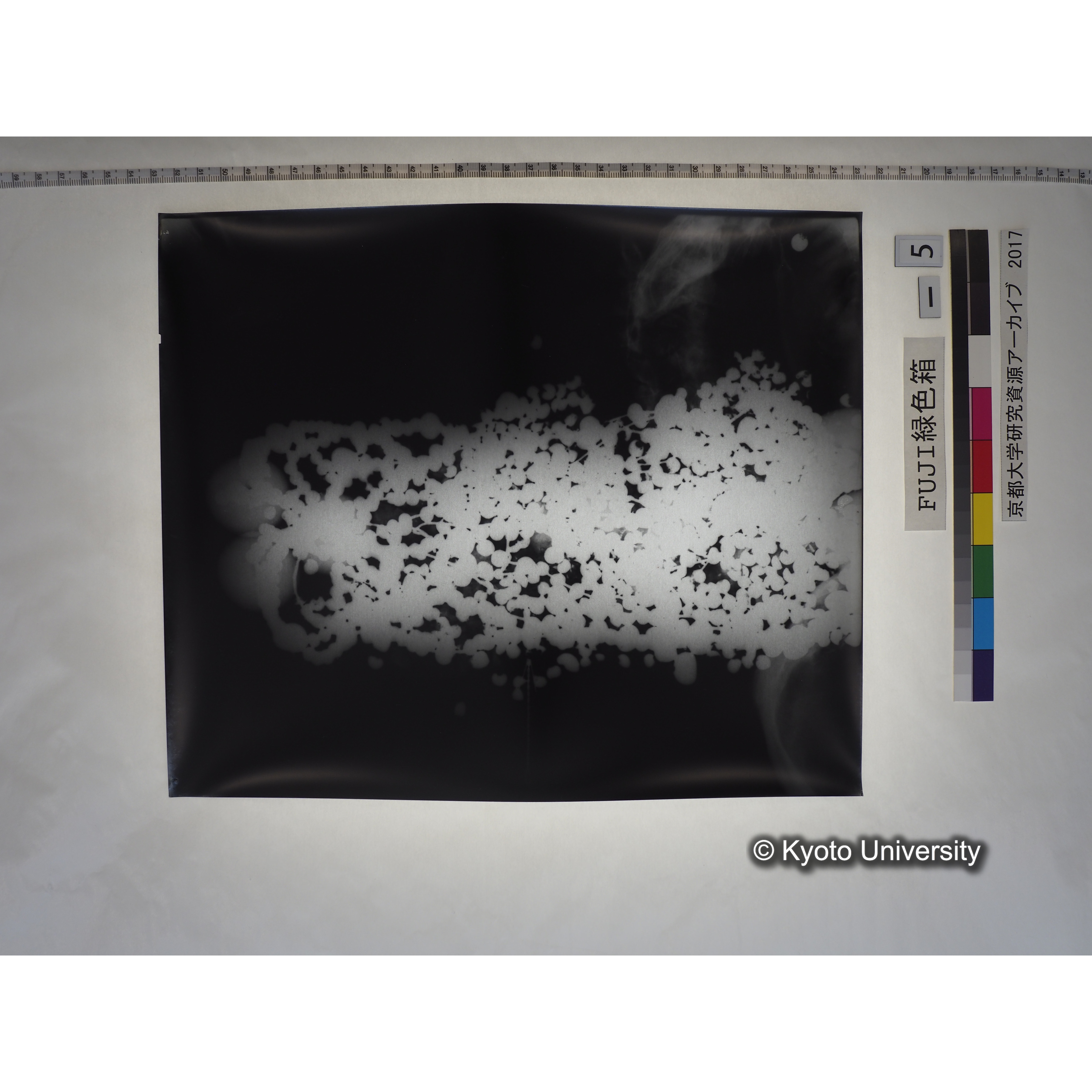 [フィルム] 玉枕レントゲン３ (1)