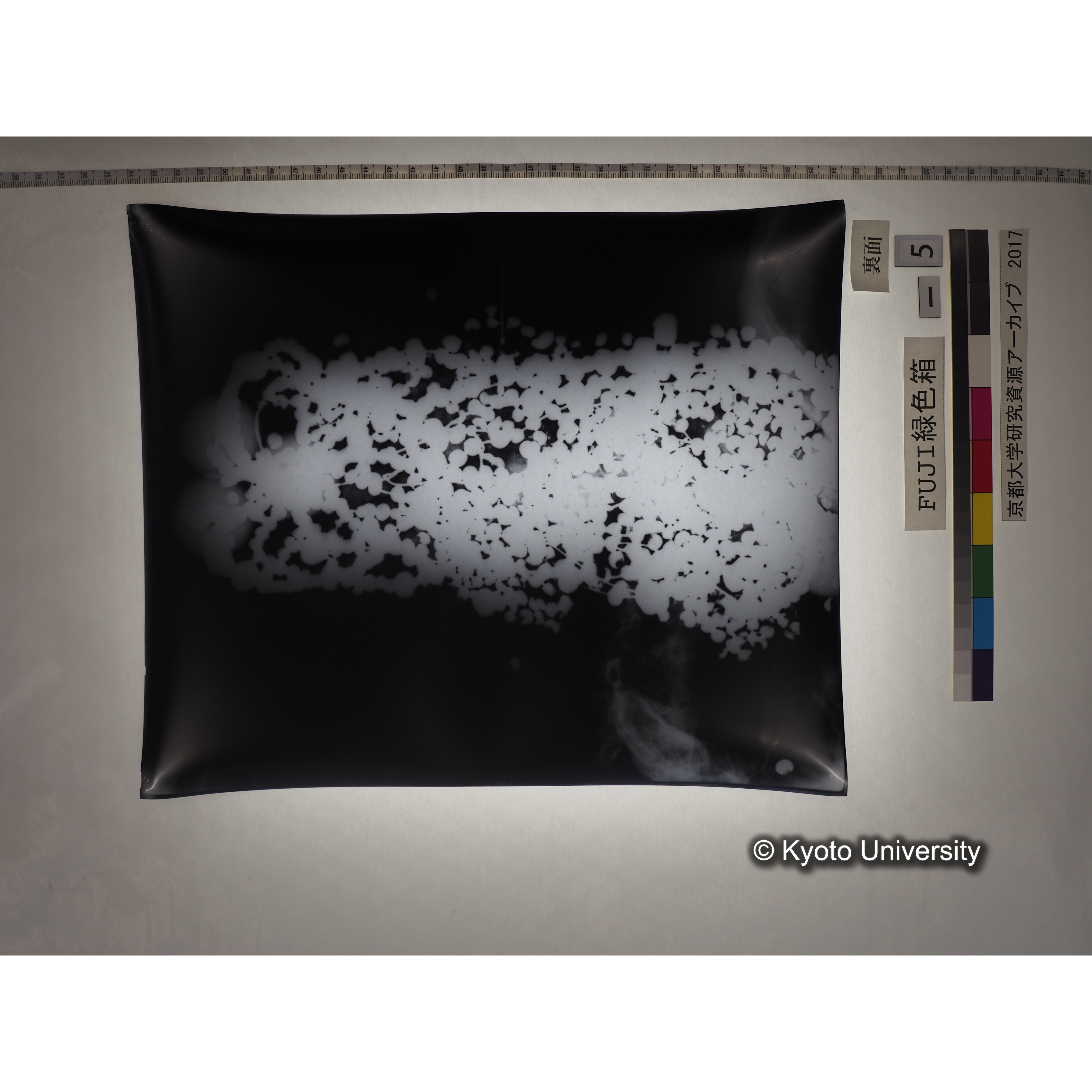 [フィルム] 玉枕レントゲン３ (2)