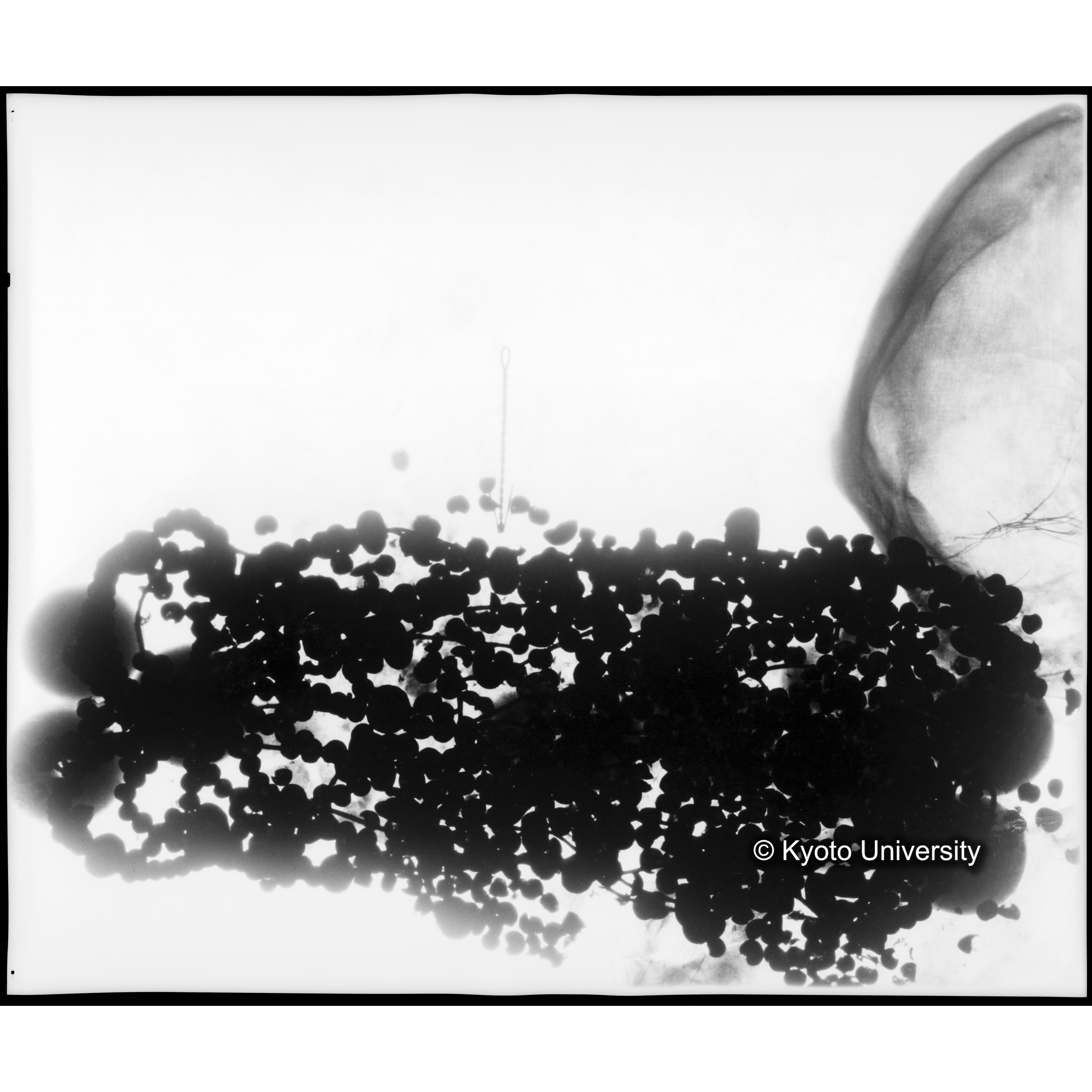 [写真内容] 玉枕レントゲン５ (1)