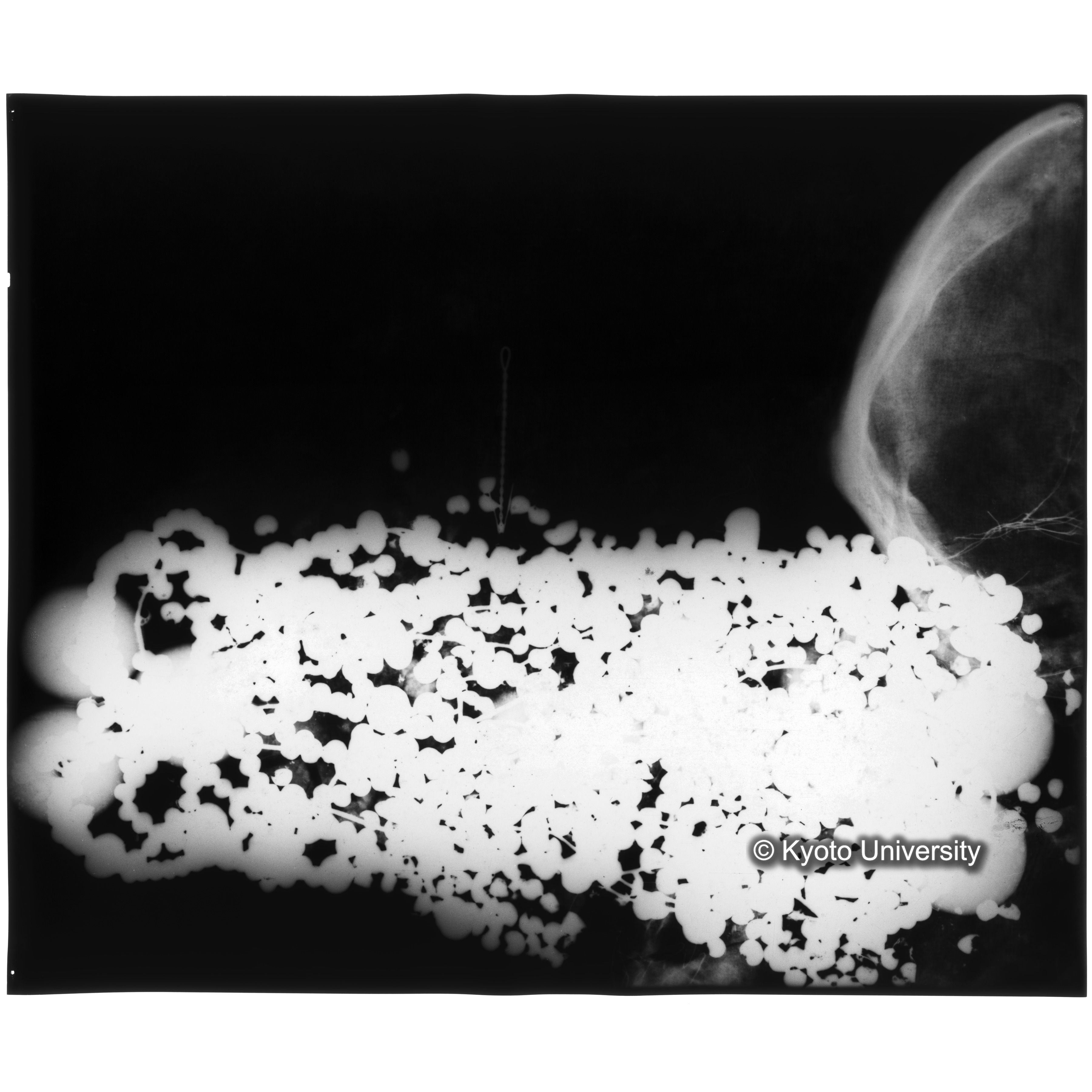 [写真内容] 玉枕レントゲン５ (3)