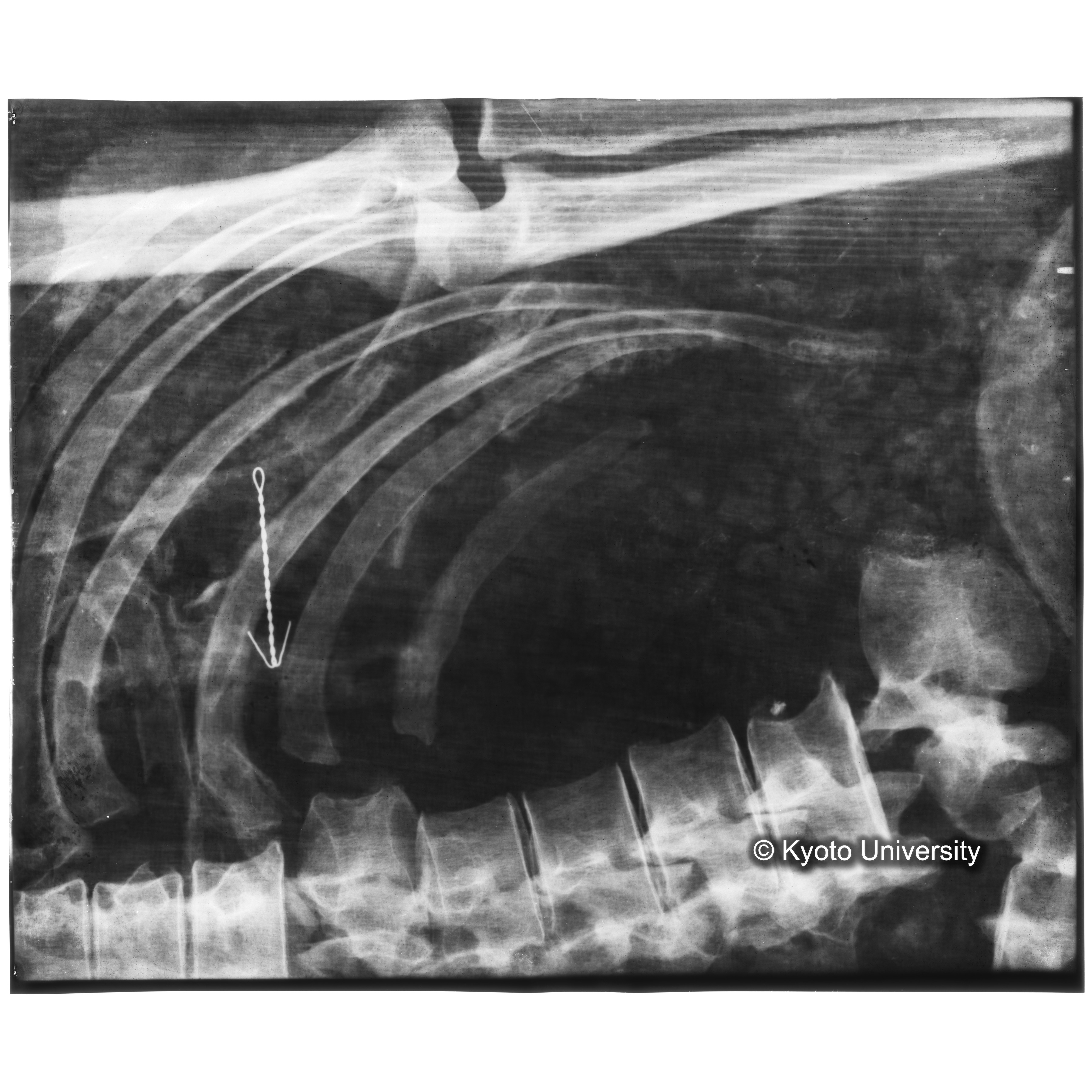 [写真内容] 胸部レントゲン (3)