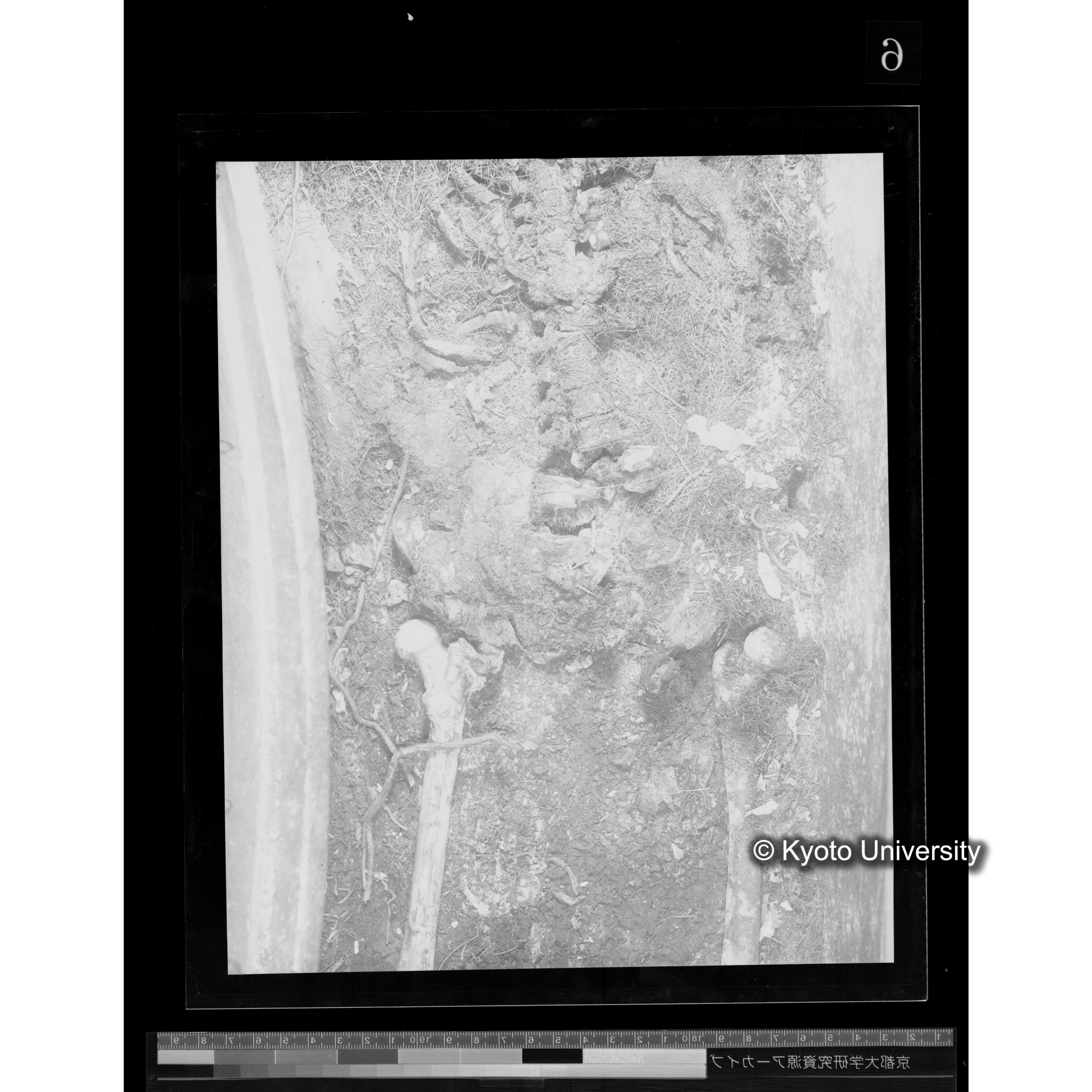 [写真内容] 胸部から腰部 (2)