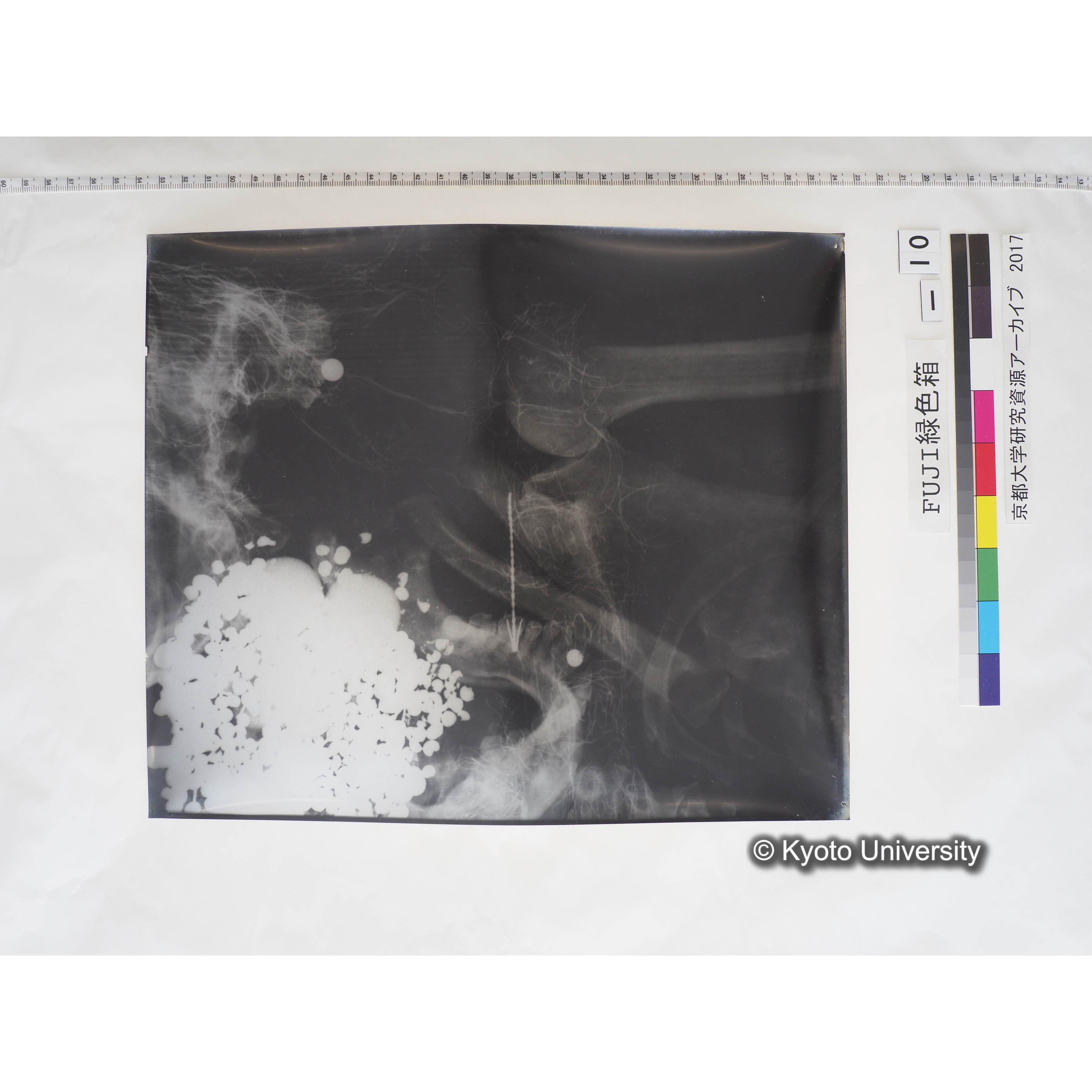 [フィルム] 顎部から胸部レントゲン (1)